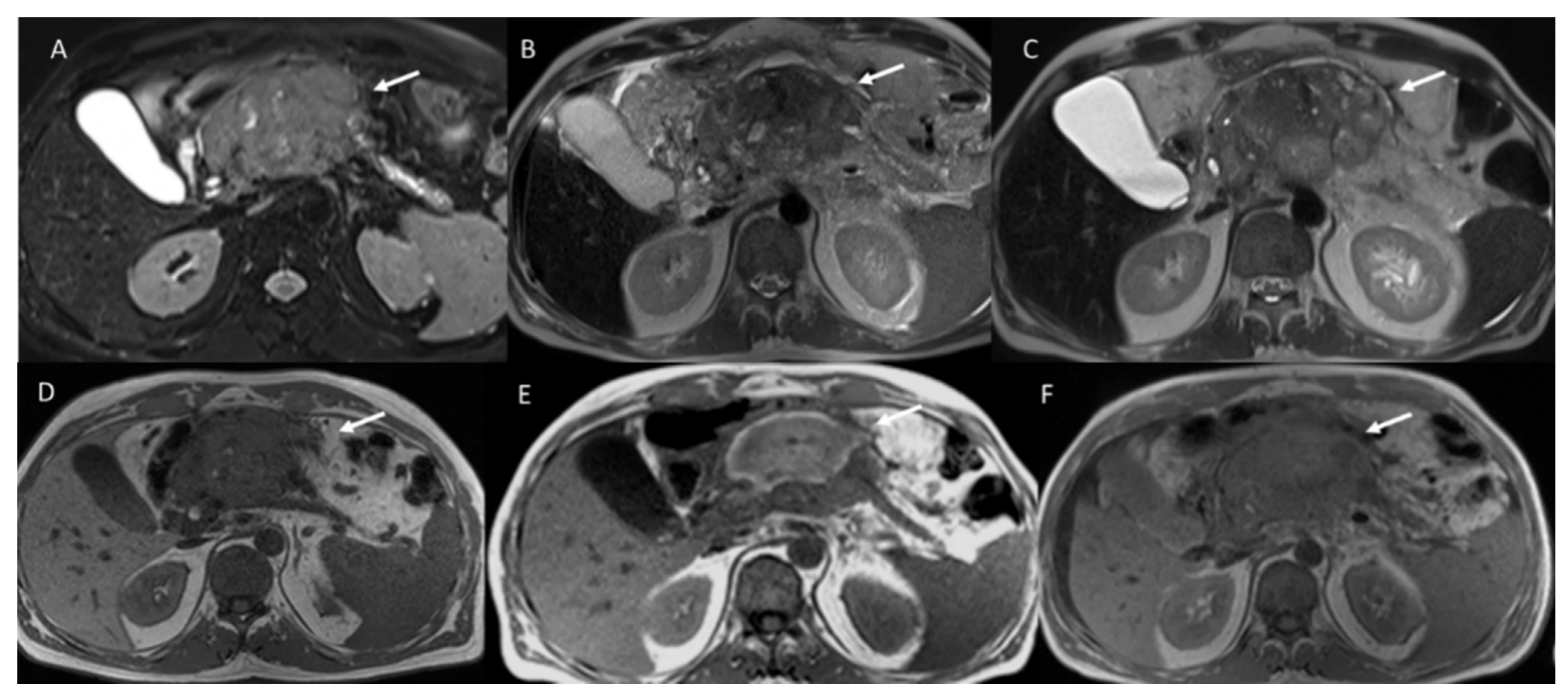 Ijerph 18 05592 g003 Ijerph 18 05592 g003