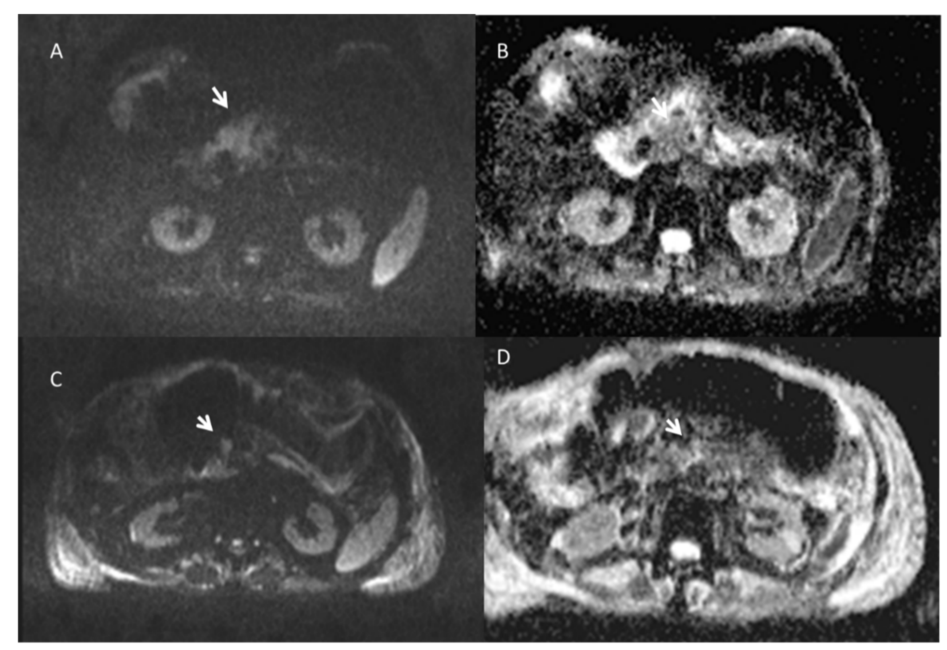 Ijerph 18 05592 g005 Ijerph 18 05592 g005