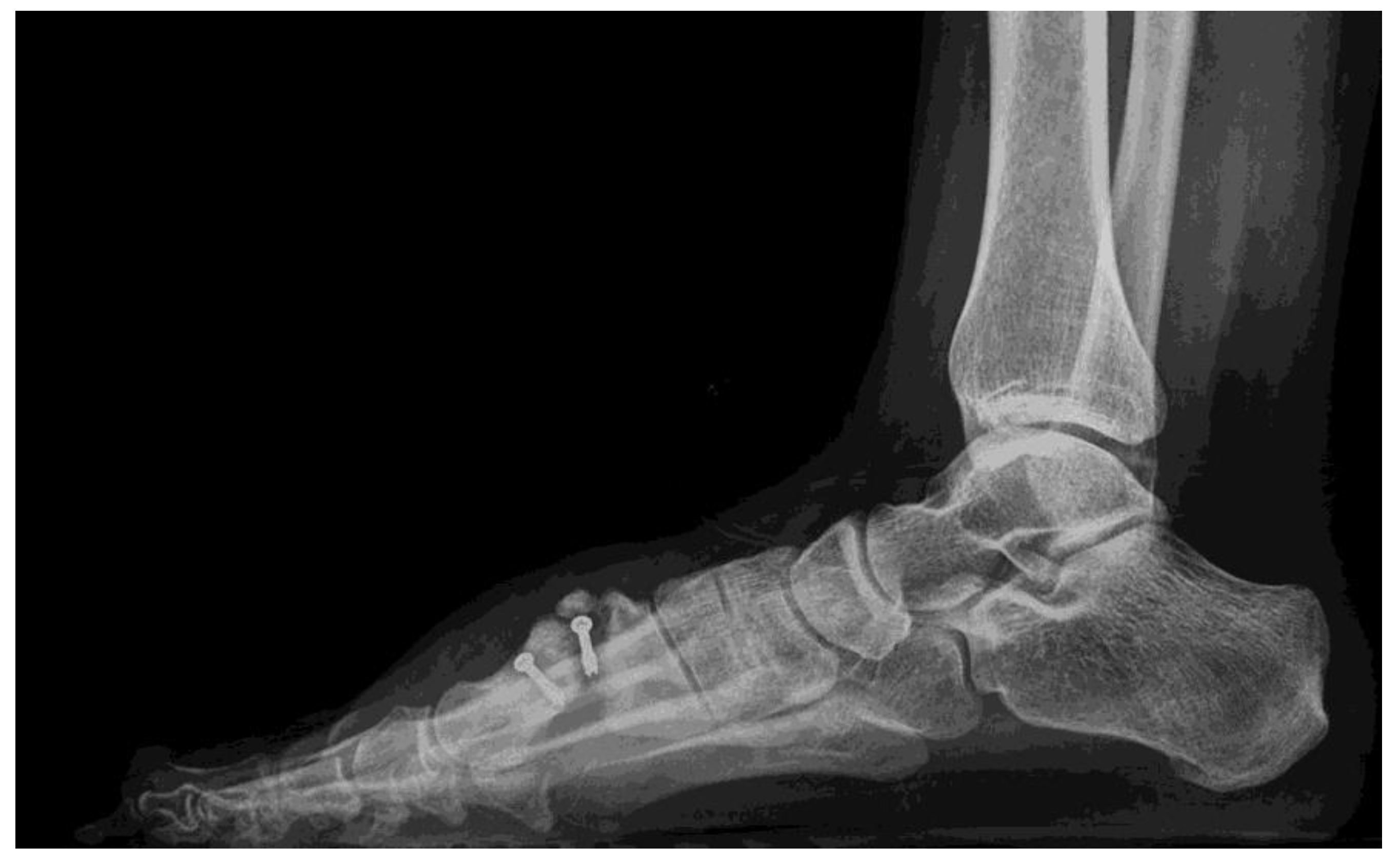 Ijerph 18 05620 g003