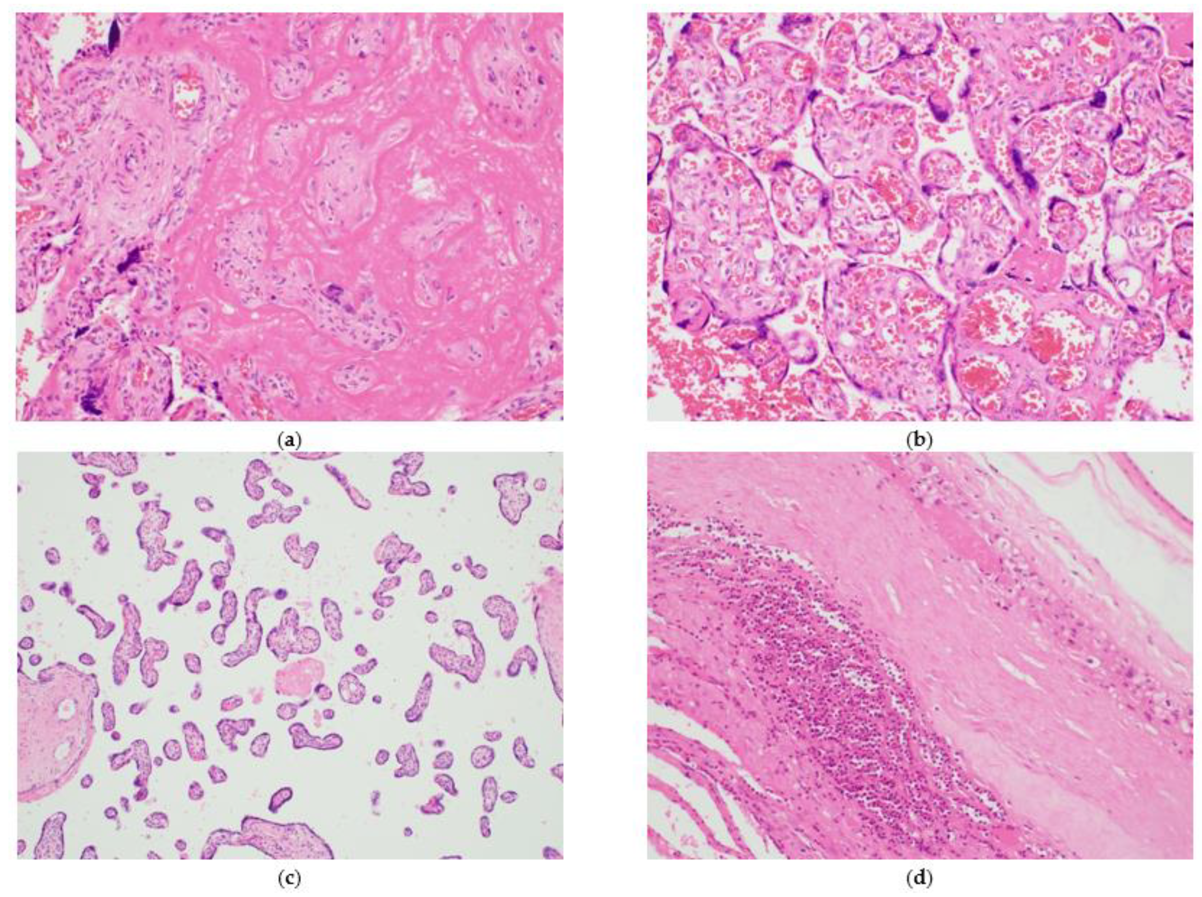 Ijerph 18 05709 g001