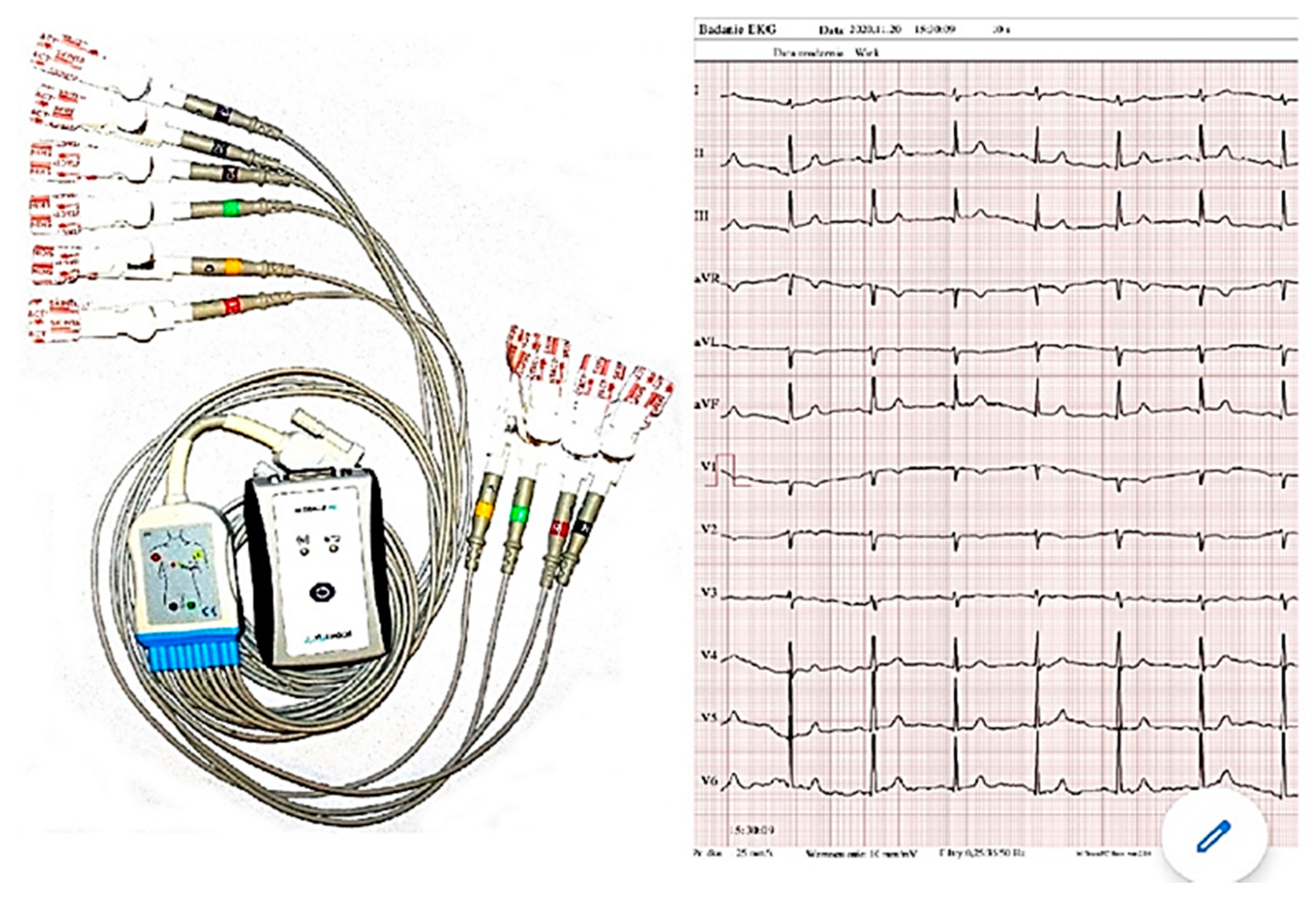 Ijerph 18 05753 g003 Ijerph 18 05753 g003