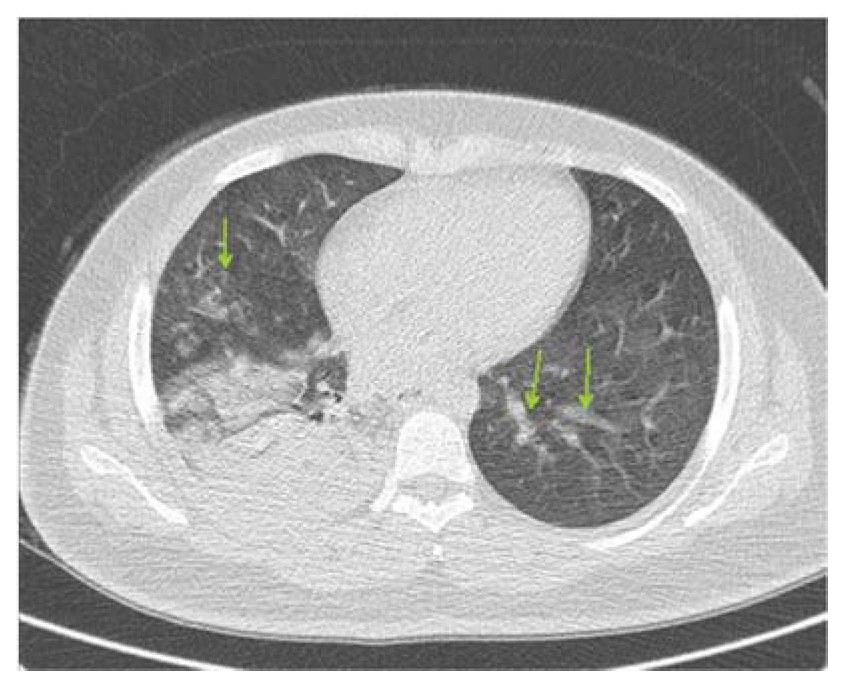 Ijerph 18 05882 g001