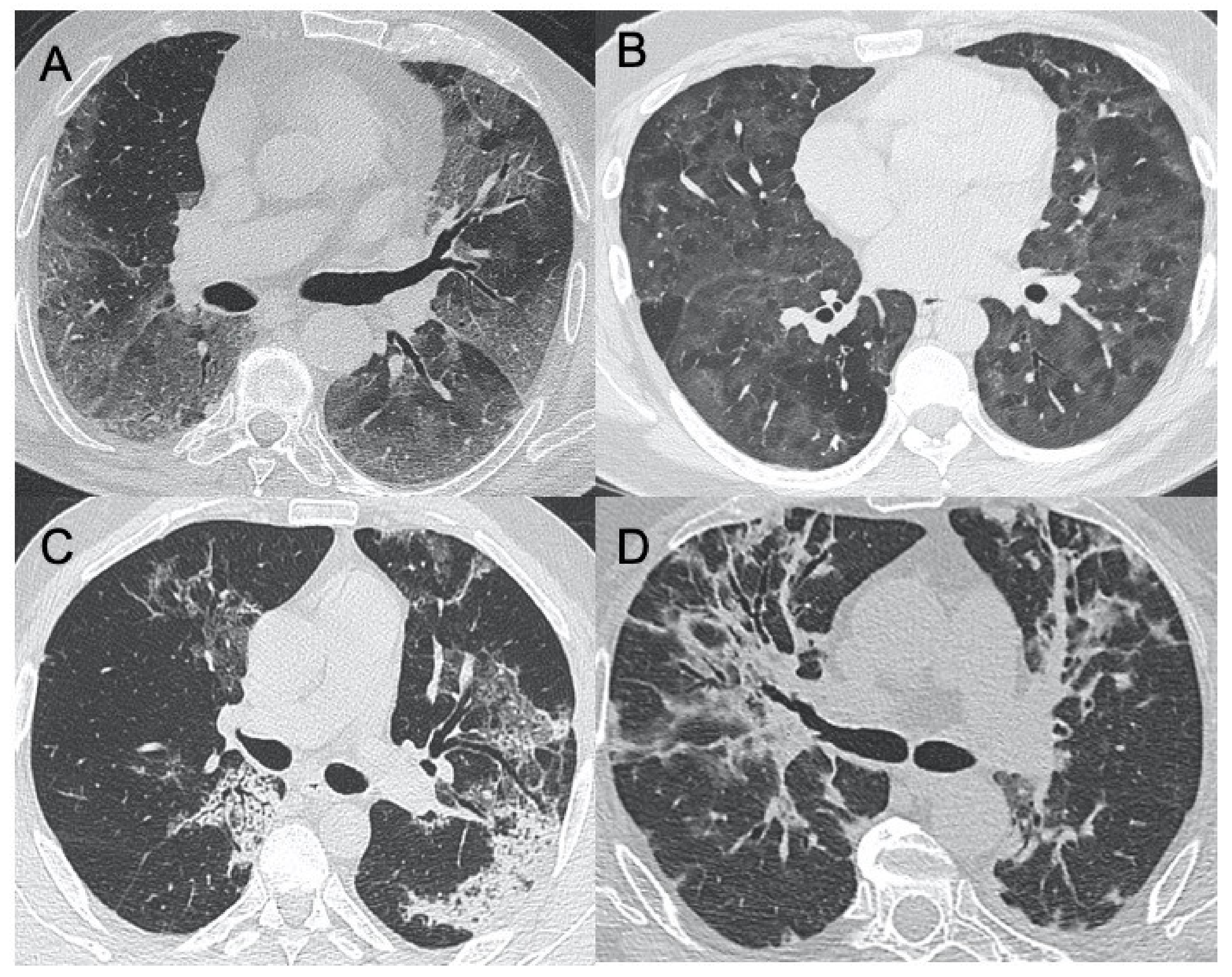 Ijerph 18 06434 g002