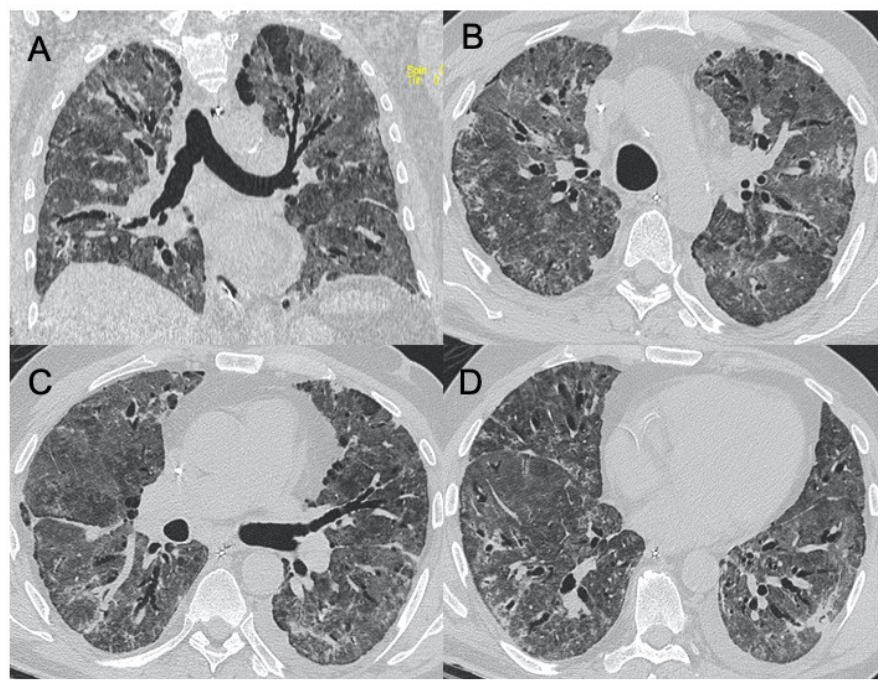 Ijerph 18 06434 g004