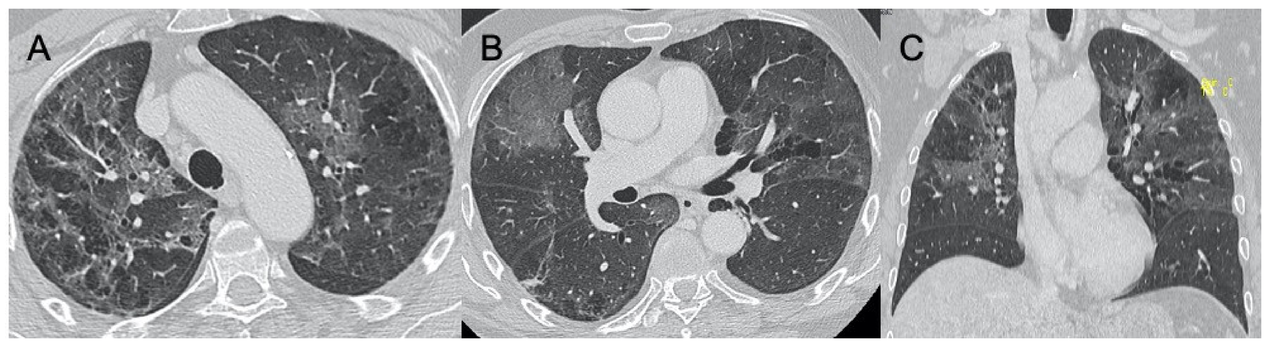Ijerph 18 06434 g006