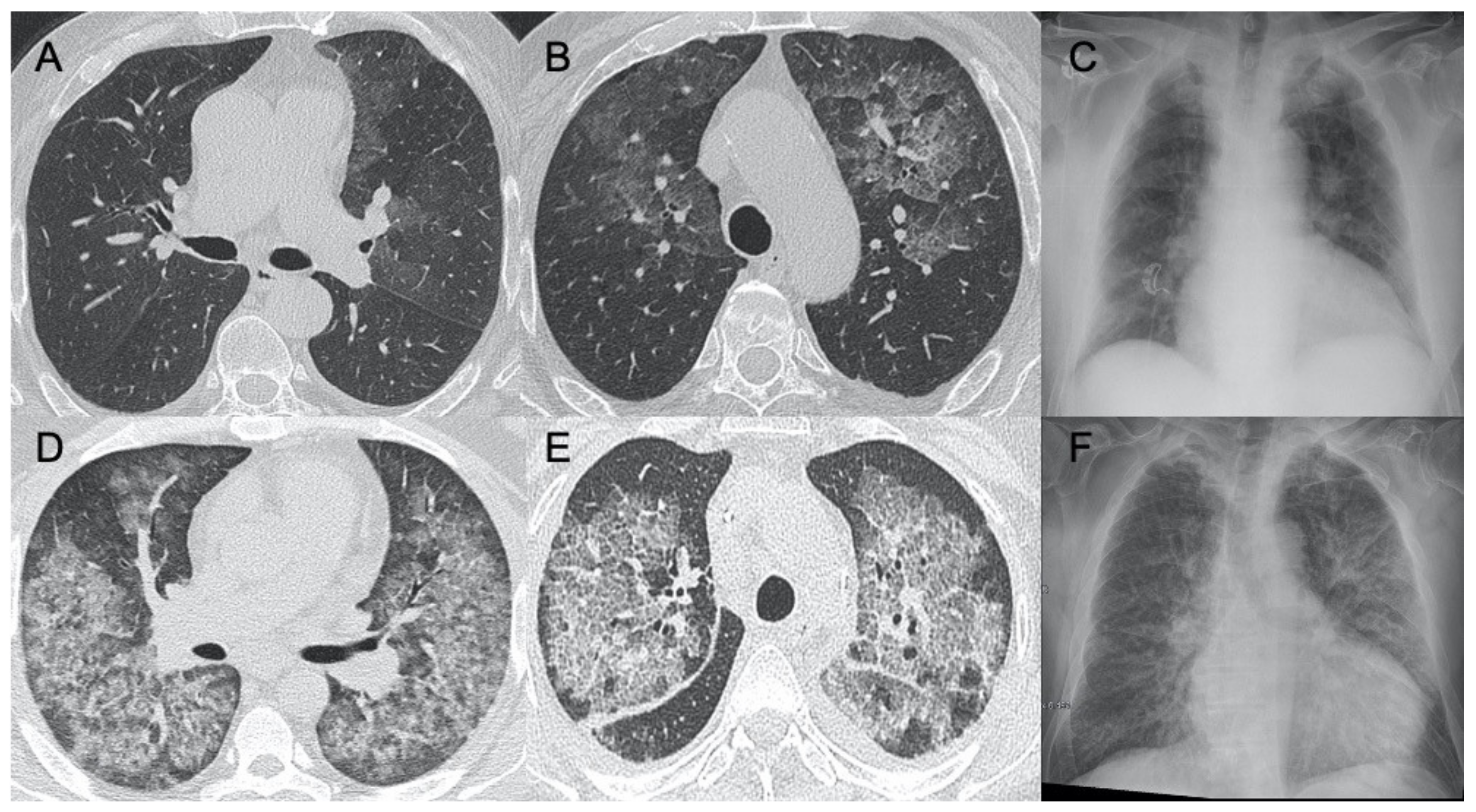 Ijerph 18 06434 g008