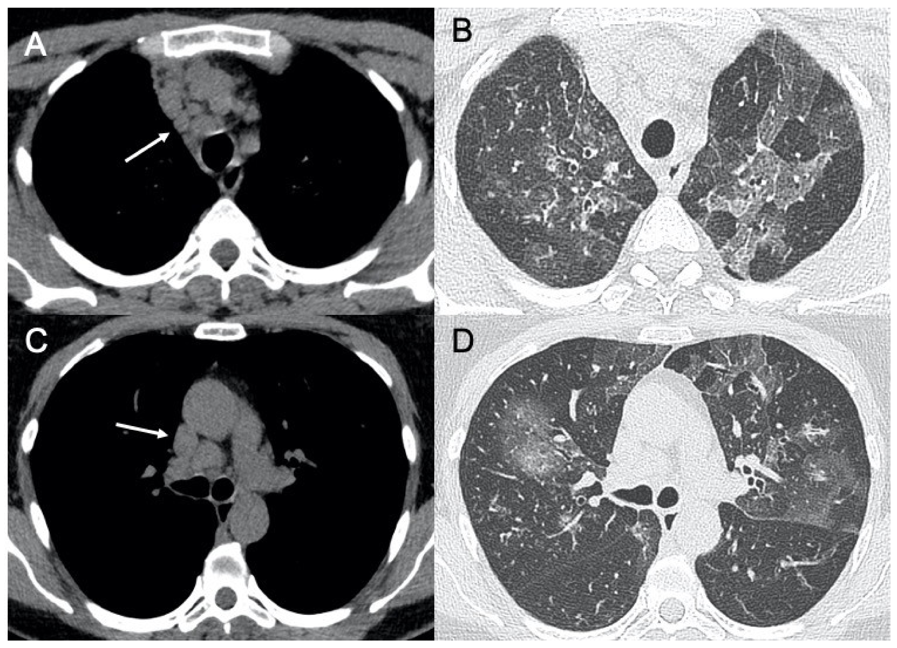 Ijerph 18 06434 g009