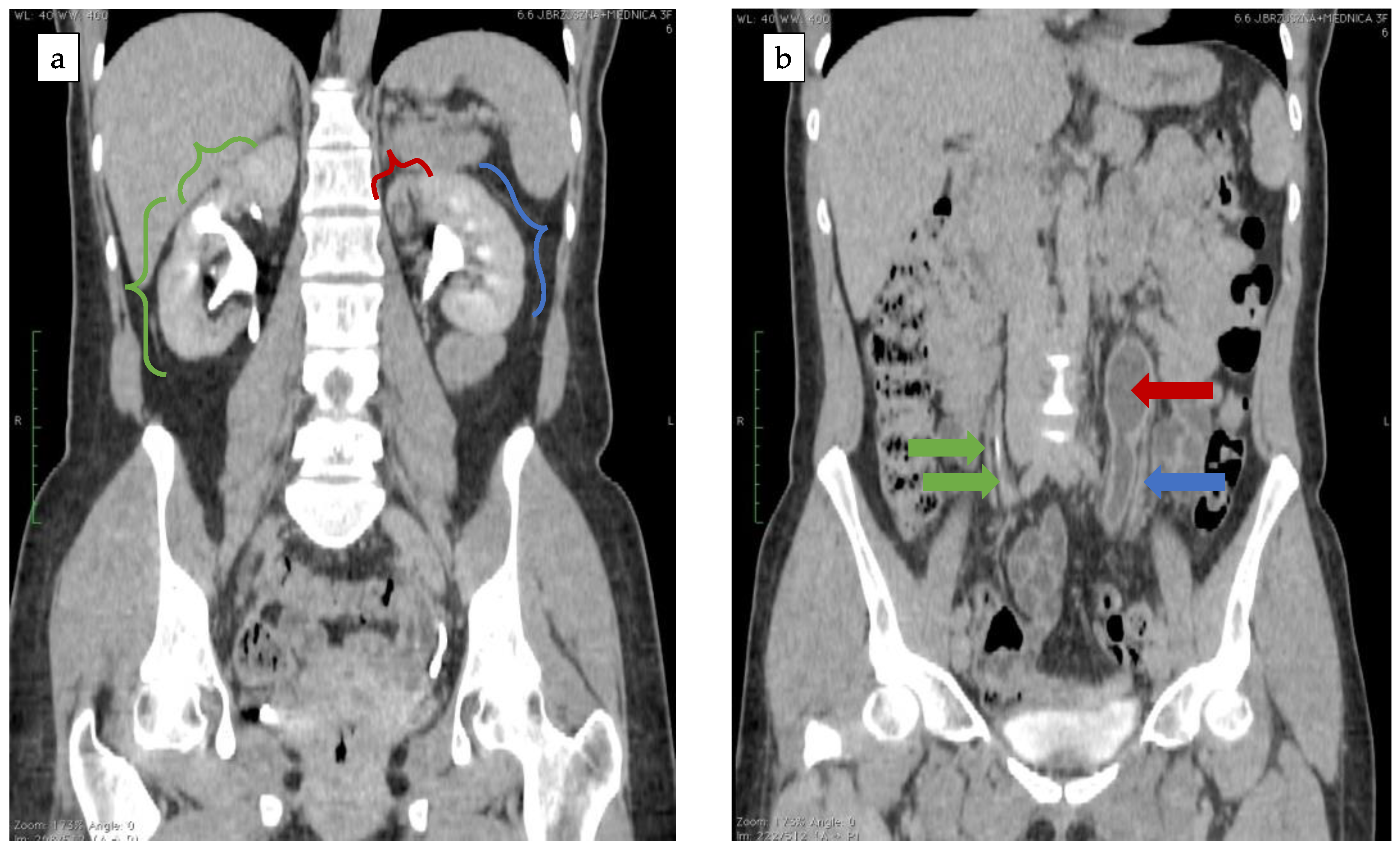 Ijerph 18 07084 g005 550