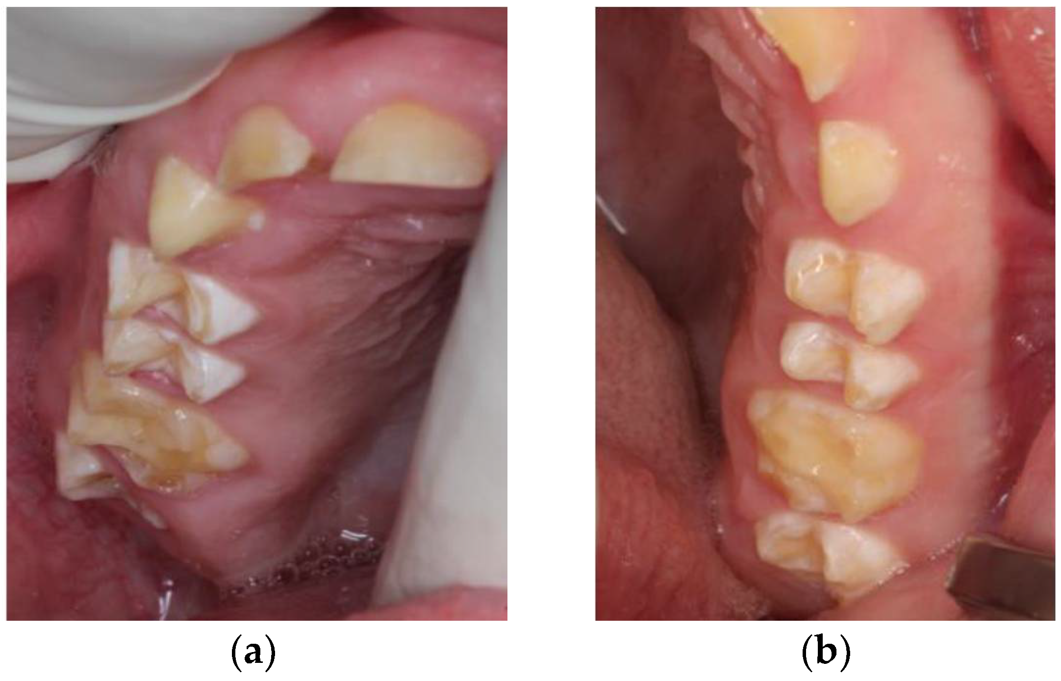 Ijerph 18 07204 g007a