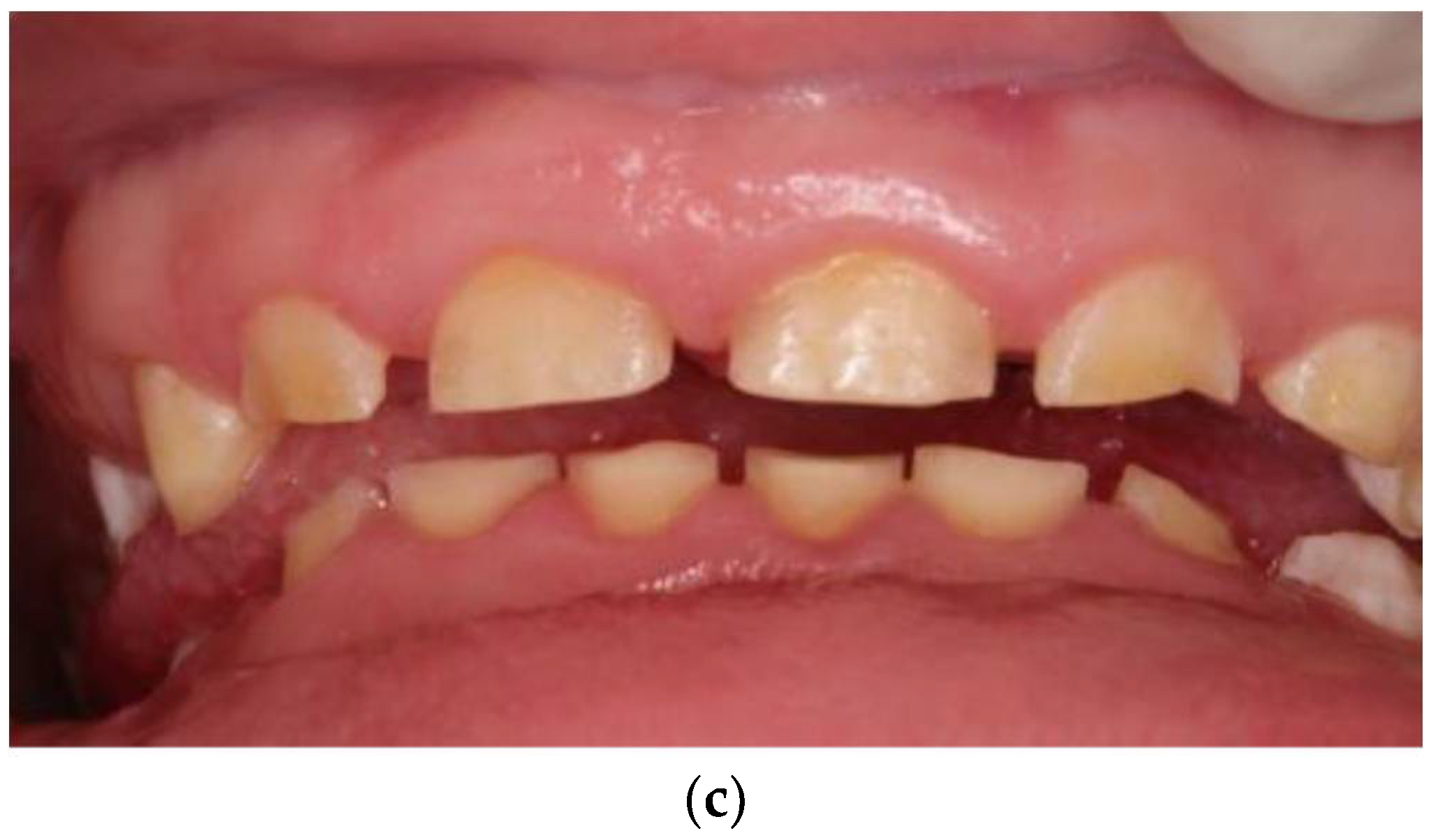 Ijerph 18 07204 g007b