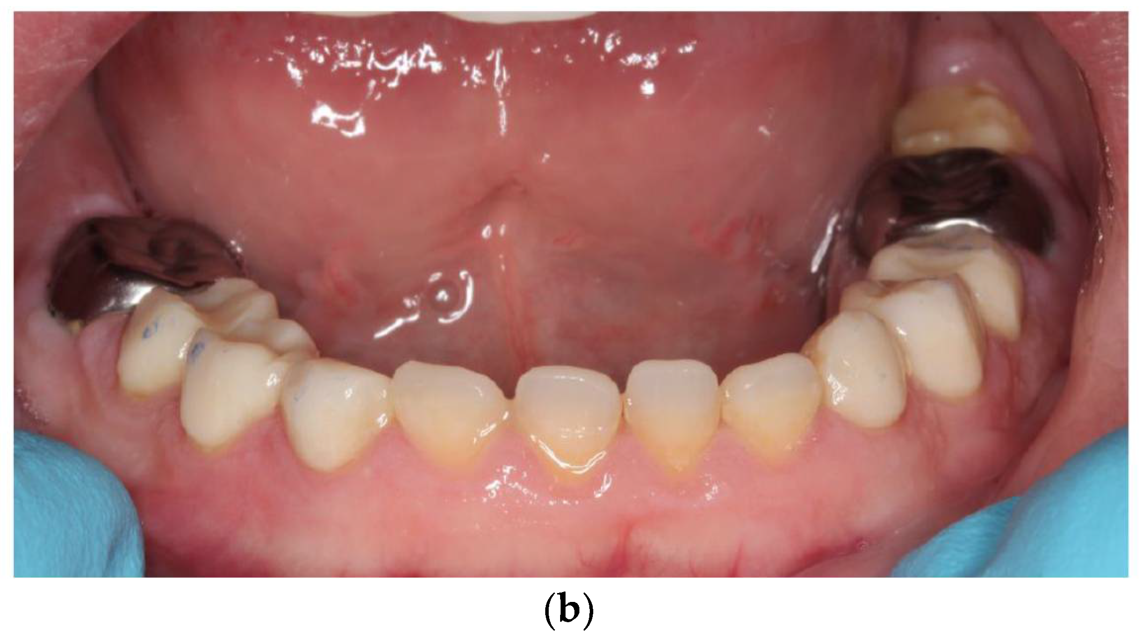 Ijerph 18 07204 g008b