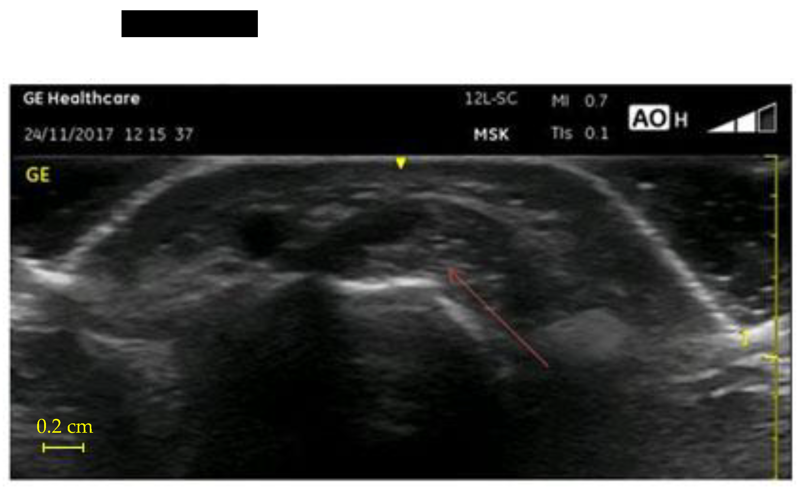 Ijerph 18 07217 g004