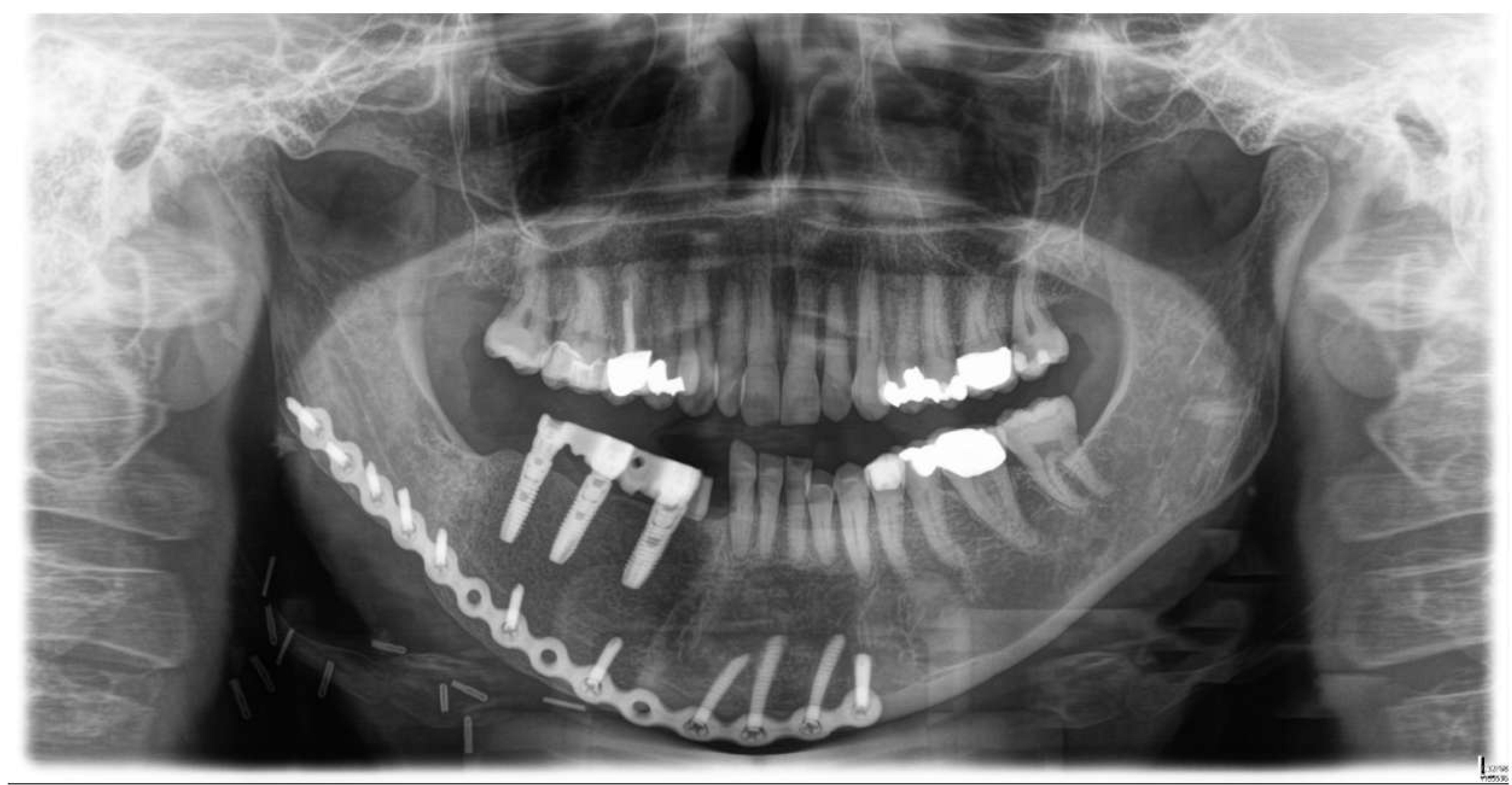 Ijerph 18 07370 g006 Ijerph 18 07370 g006