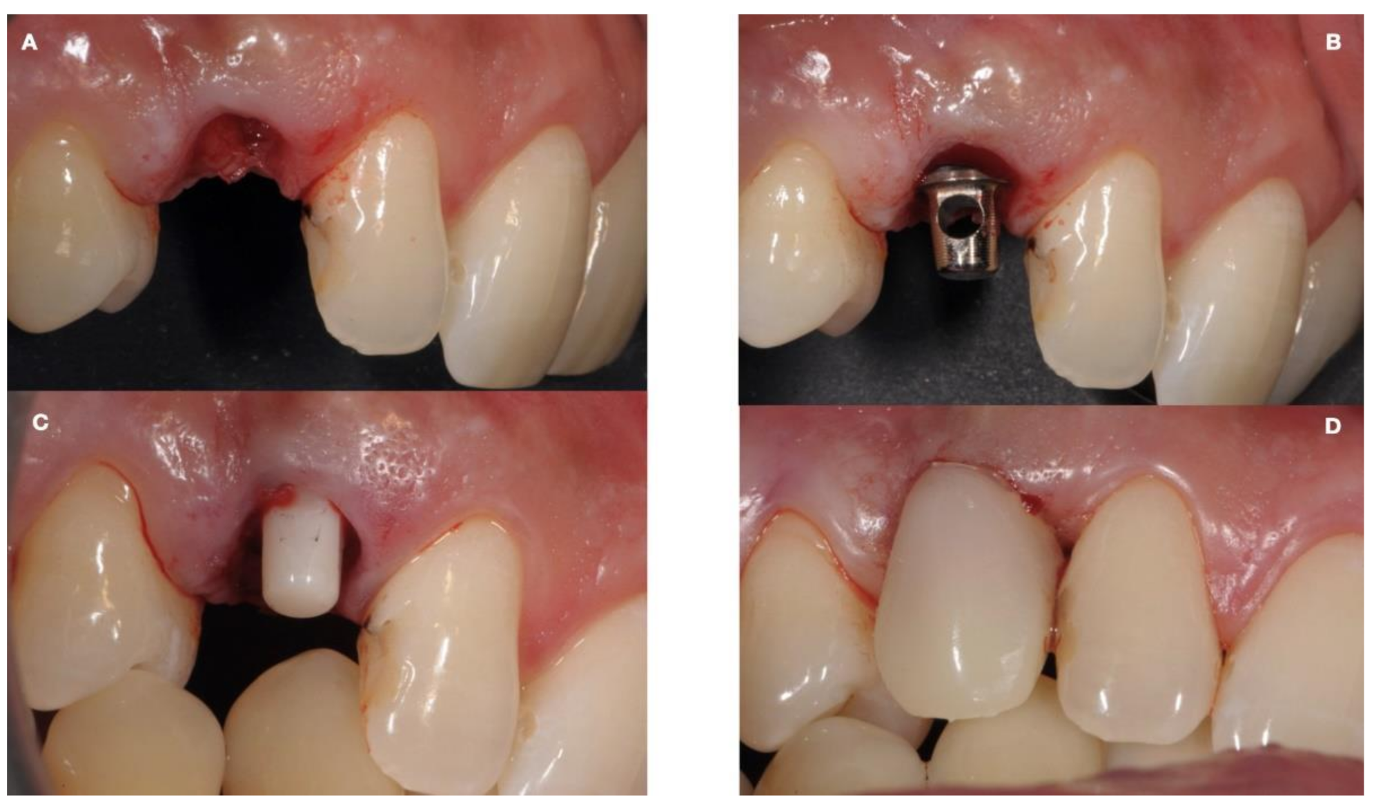 Ijerph 18 07998 g004 Ijerph 18 07998 g004