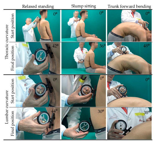 Ijerph Special Issue Injury Prevention In Sport