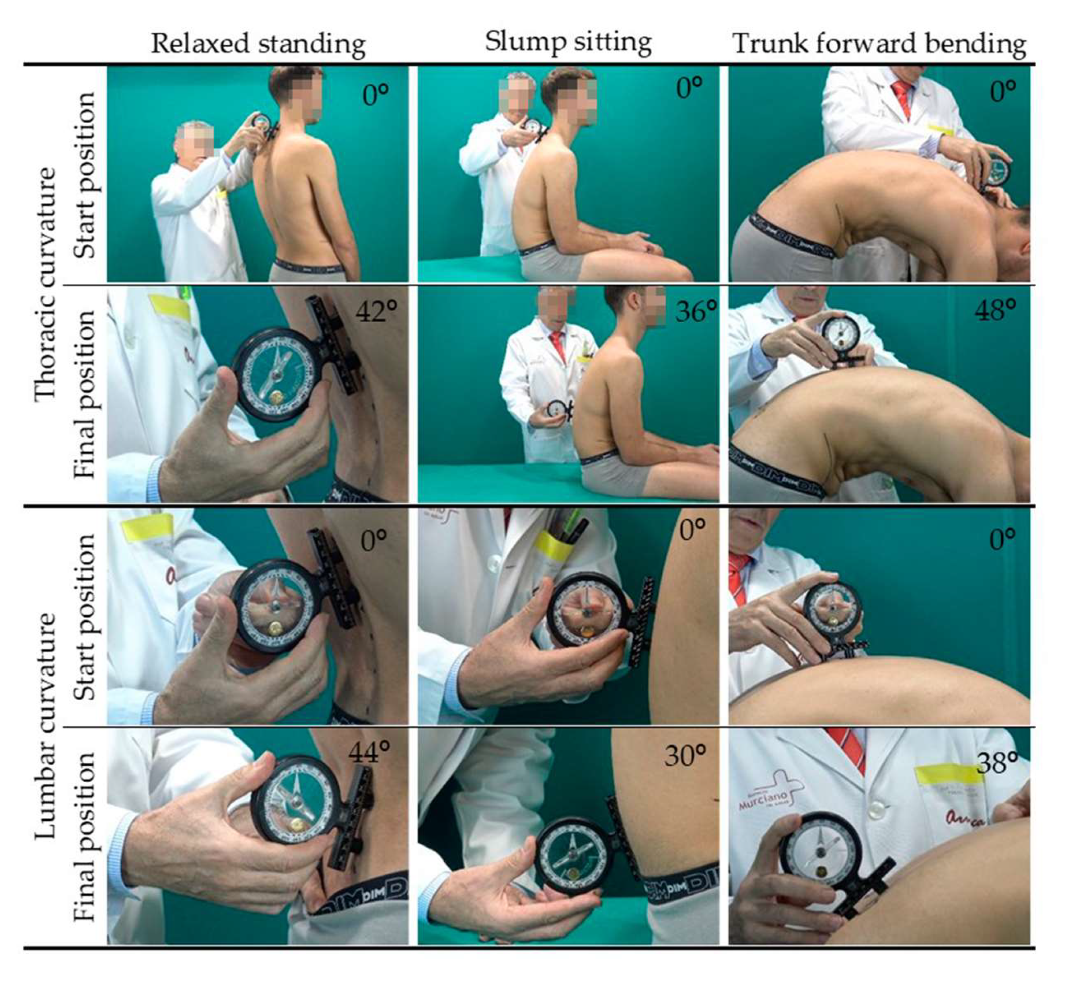 IJERPH Free Full-Text Sagittal Integral Morphotype of Competitive Amateur Athletes and Its Potential Relation with Recurrent Low Back Pain