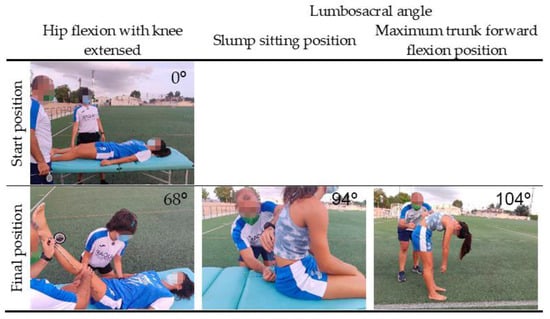 IJERPH Free Full-Text The Potential Role of Hamstring Extensibility on Sagittal Pelvic Tilt, Sagittal Spinal Curves and Recurrent Low Back Pain in Team Sports Players A Gender Perspective Analysis pic