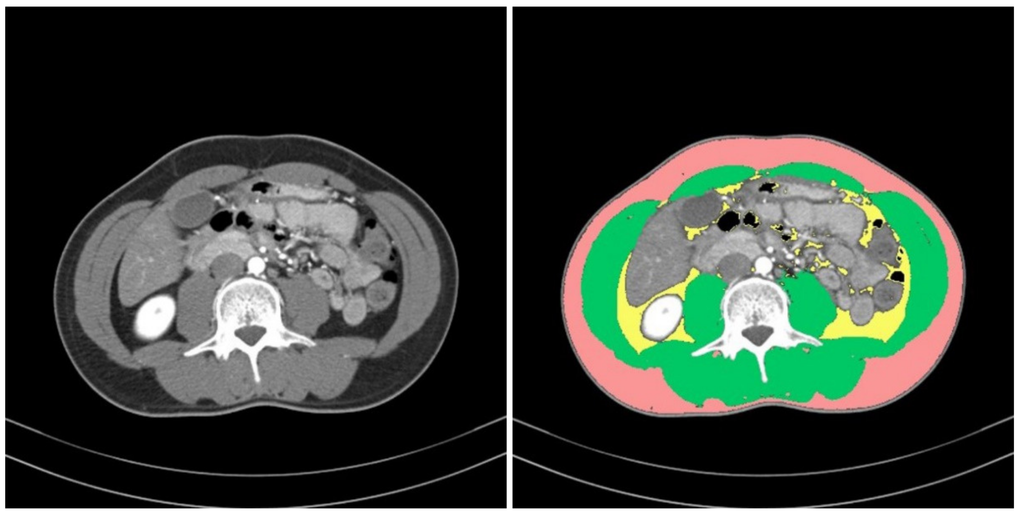 Ijerph 18 08710 g002 550