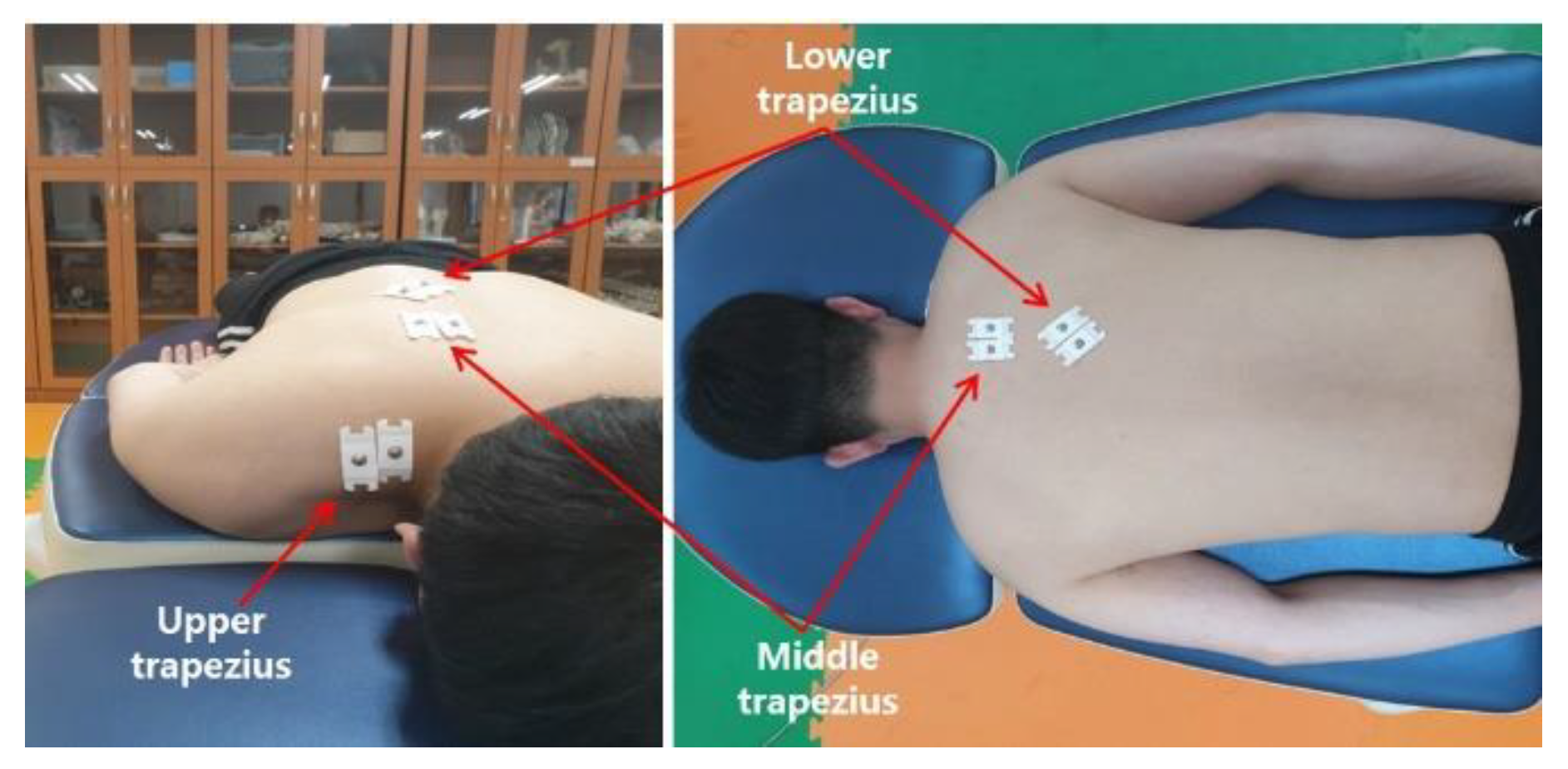 Effects of Intended Scapular Posterior Tilt Motion on Trapezius Muscle Electromyography Activity