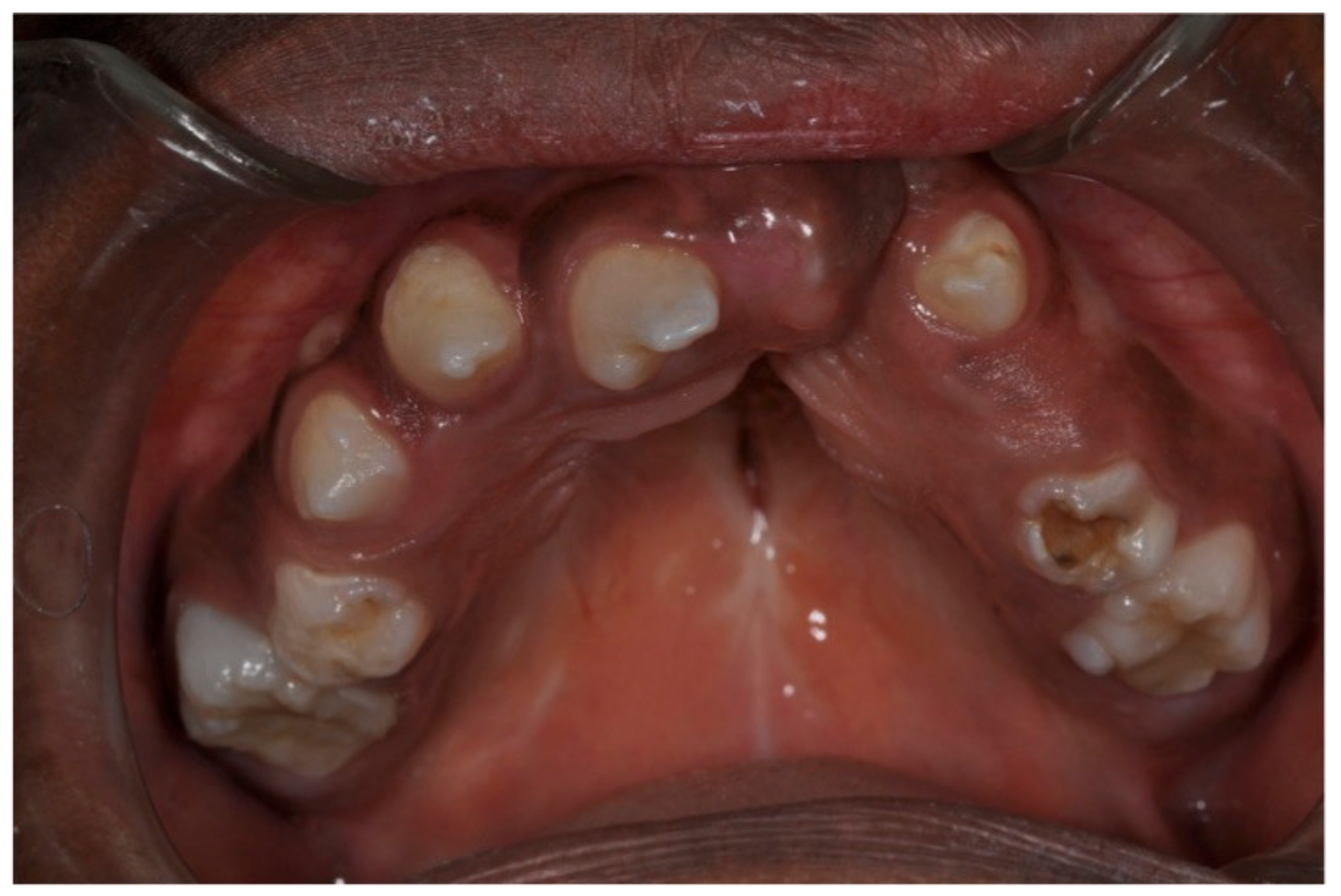 Ijerph 18 09487 g003 Ijerph 18 09487 g003