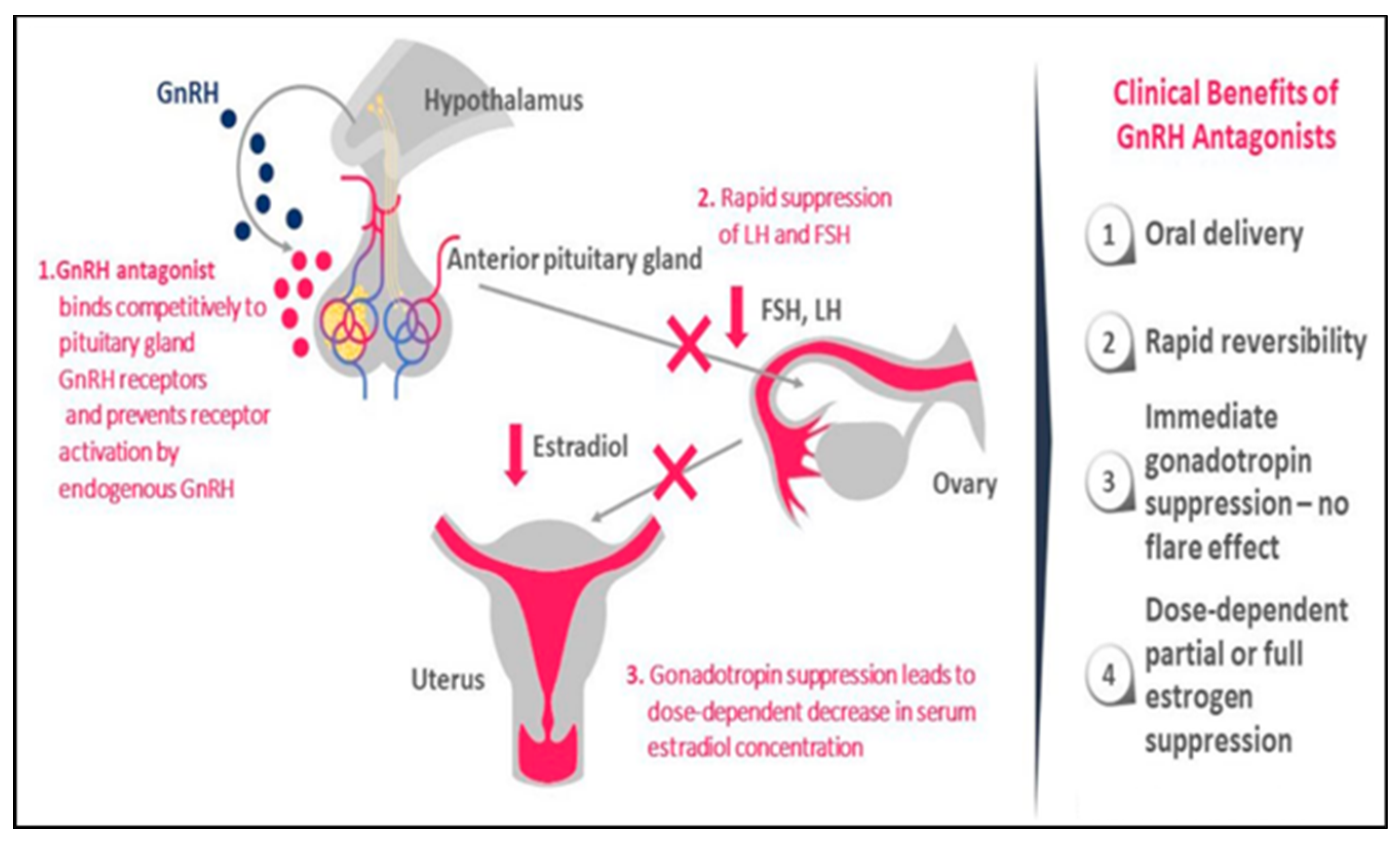 IJERPH Free FullText Uterine Adenomyosis From Disease