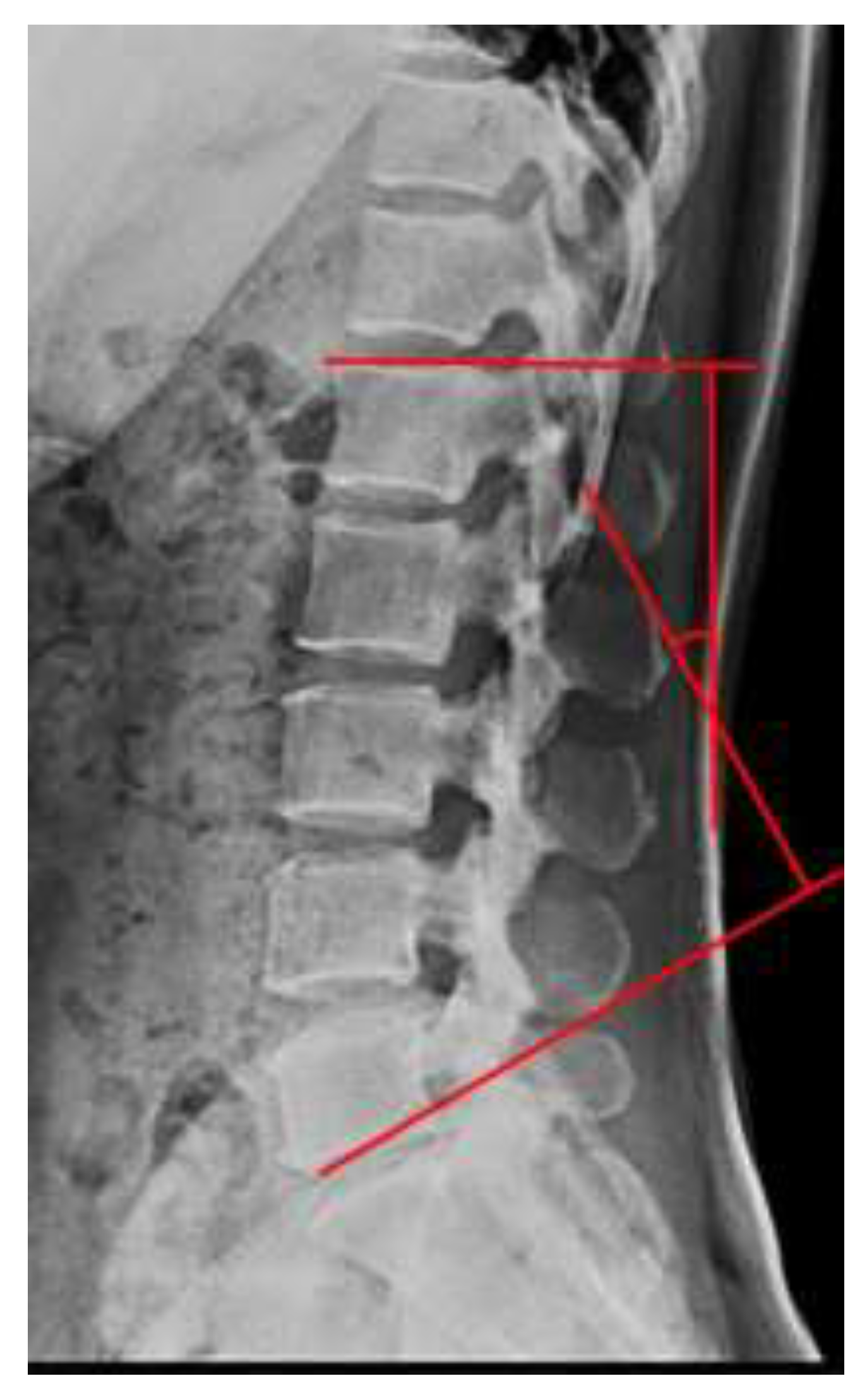 This Curve Changed Everything: Celebs & Lumbar Lordosis - halfbwo