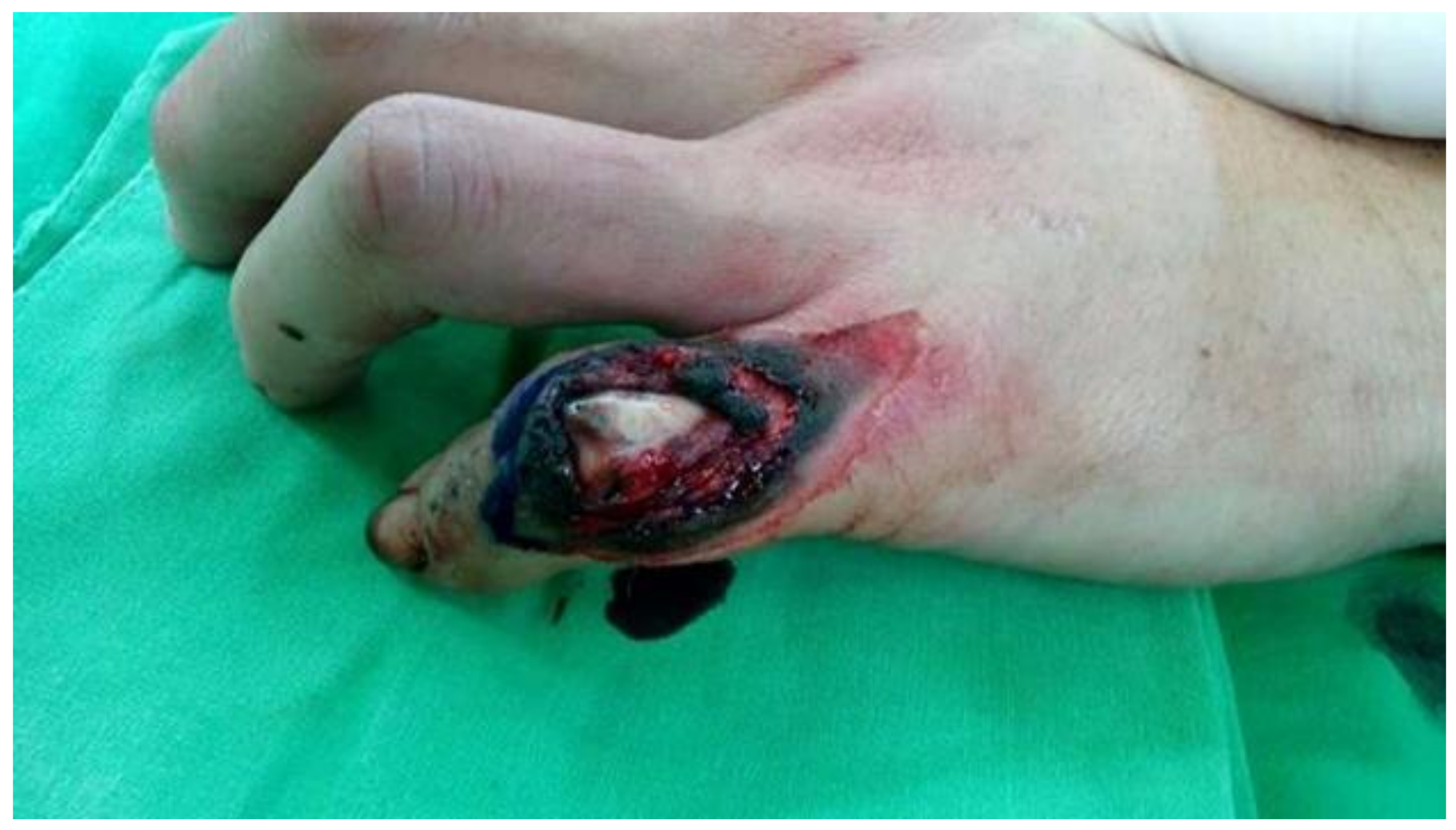 Ijerph 18 11081 g001