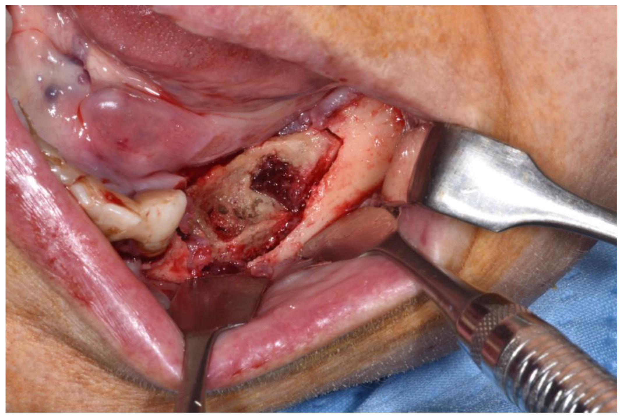 Ijerph 18 11362 g004