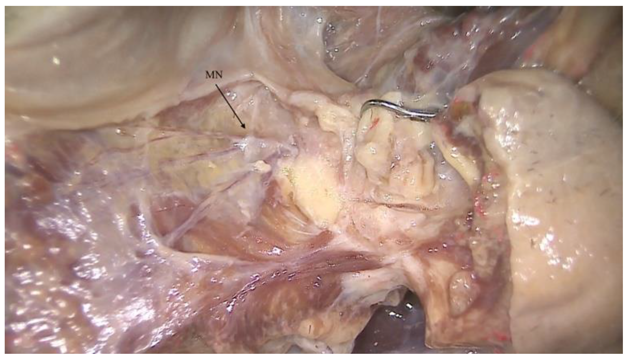 Ijerph 18 11915 g001 550