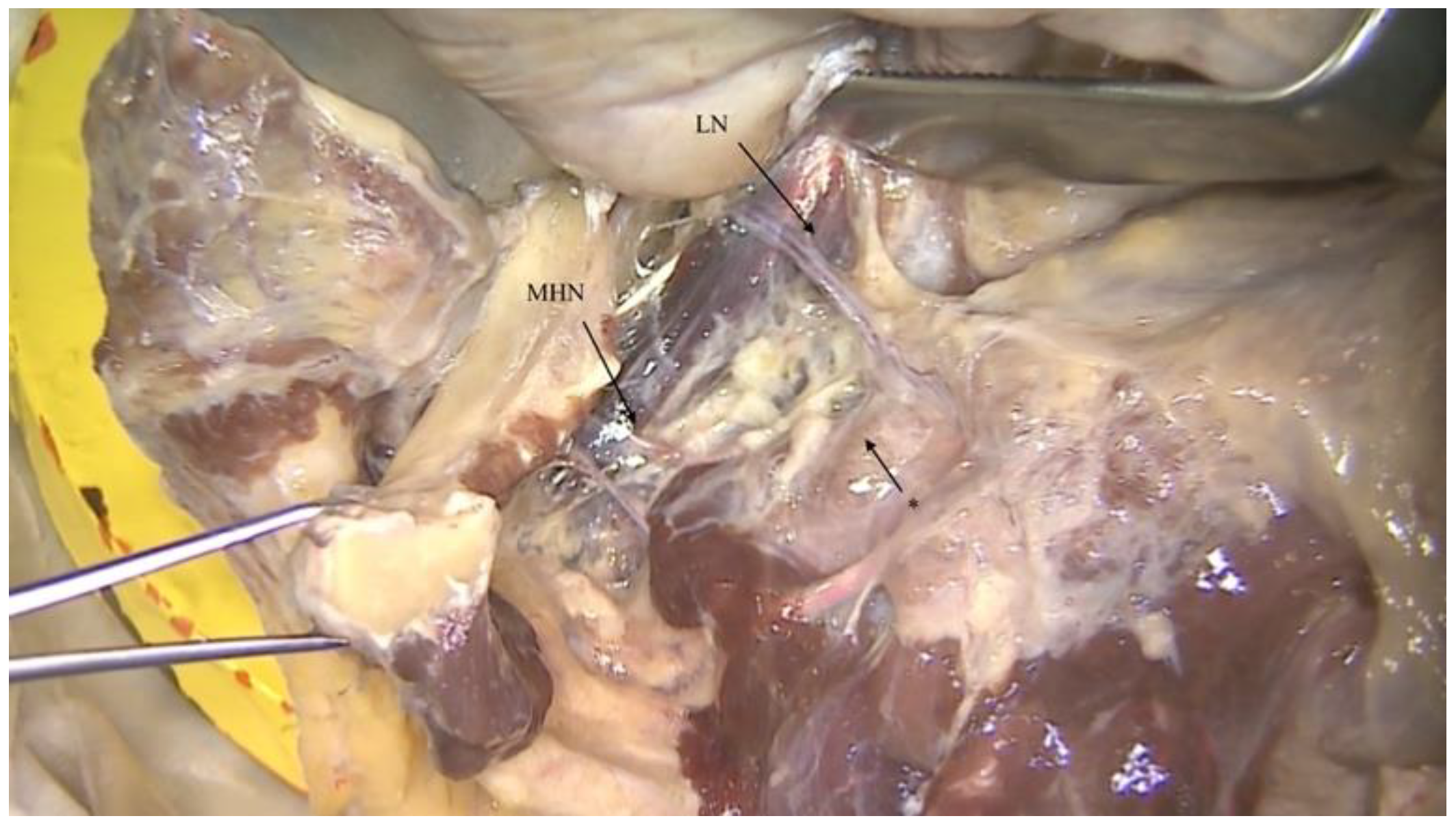 Ijerph 18 11915 g002 550