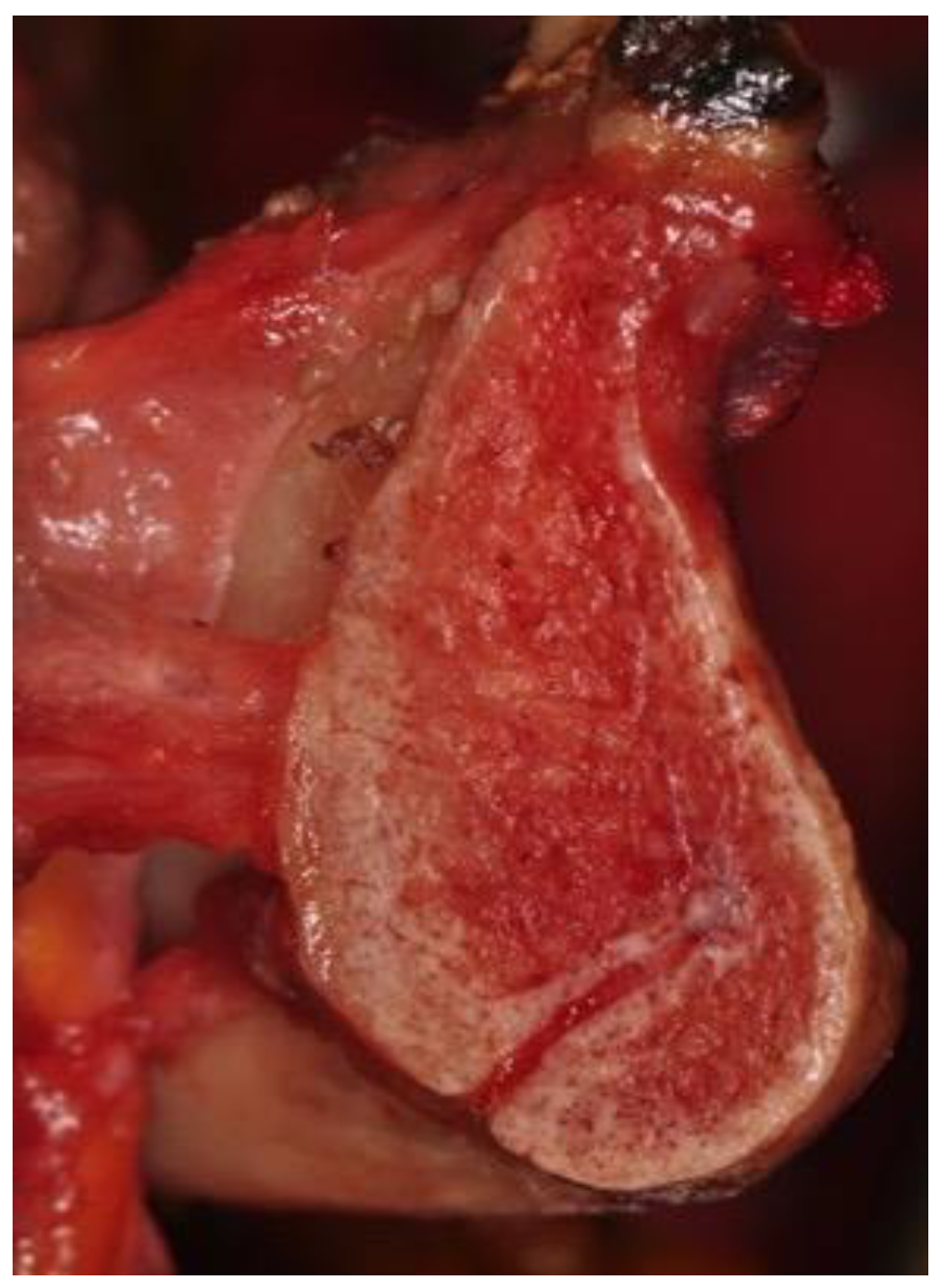 Ijerph 18 11915 g004 550