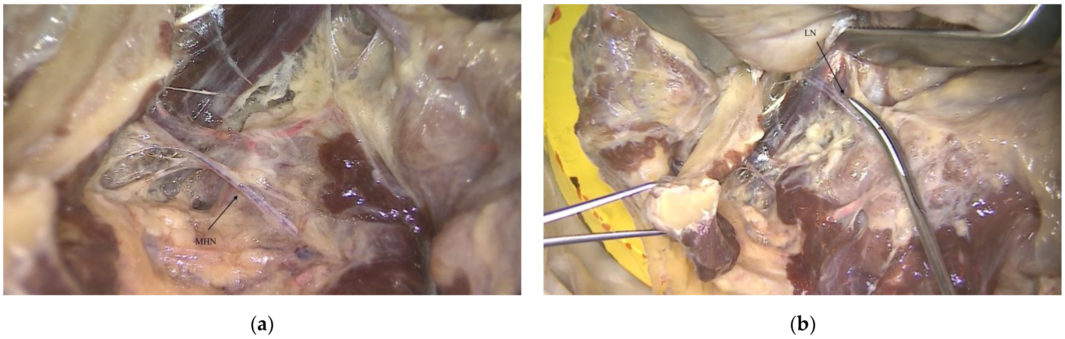 Ijerph 18 11915 g005a 550