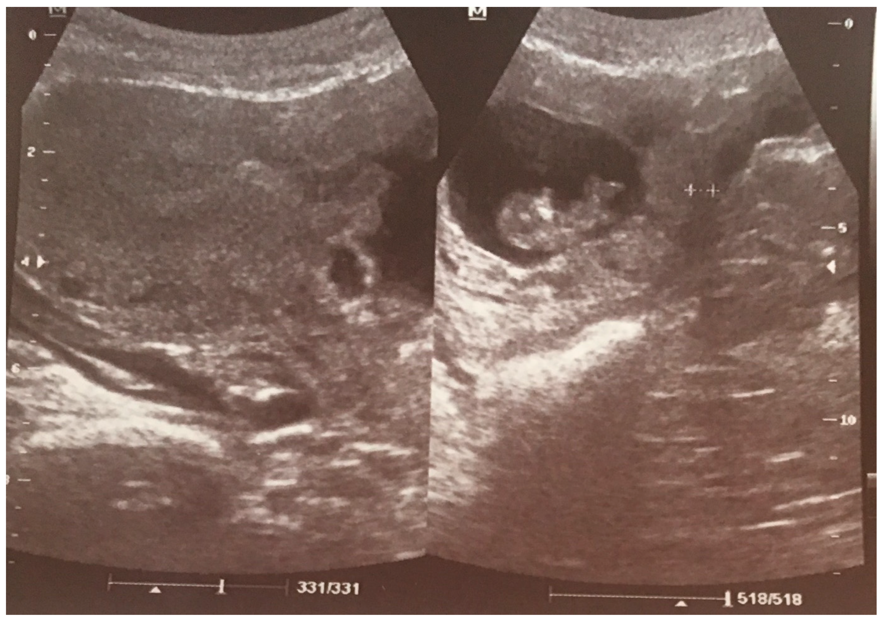 Ijerph 18 11998 g002