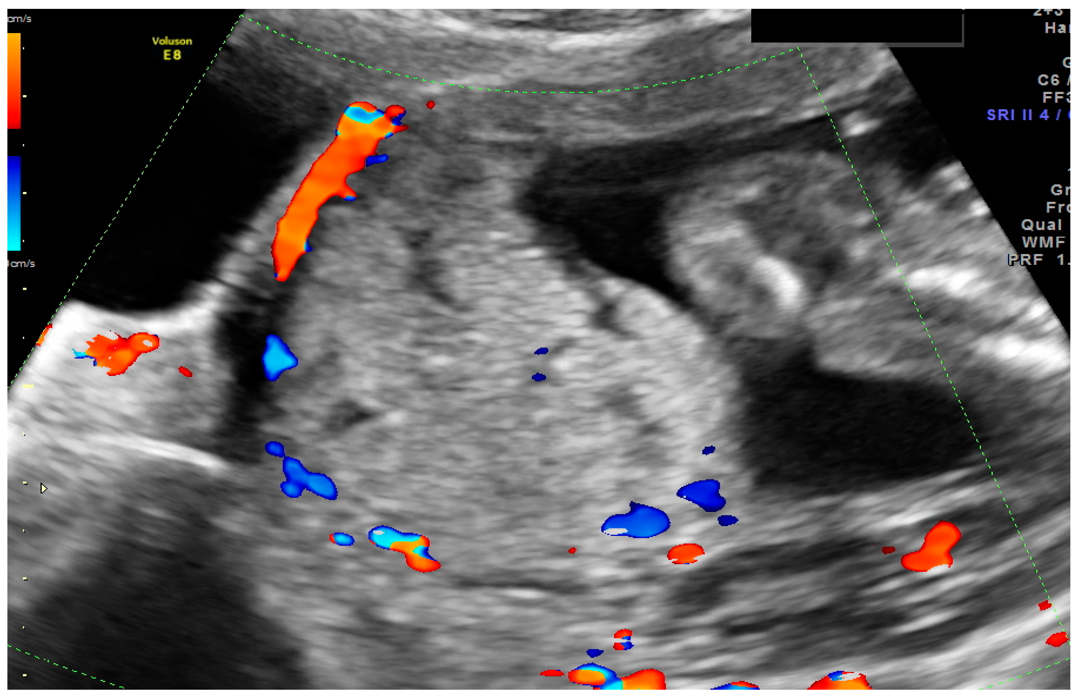 Ijerph 18 11998 g003