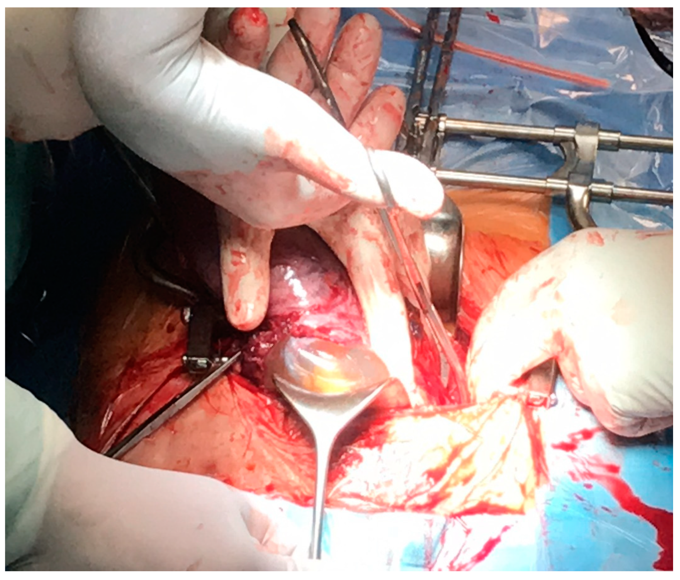 Ijerph 18 11998 g005