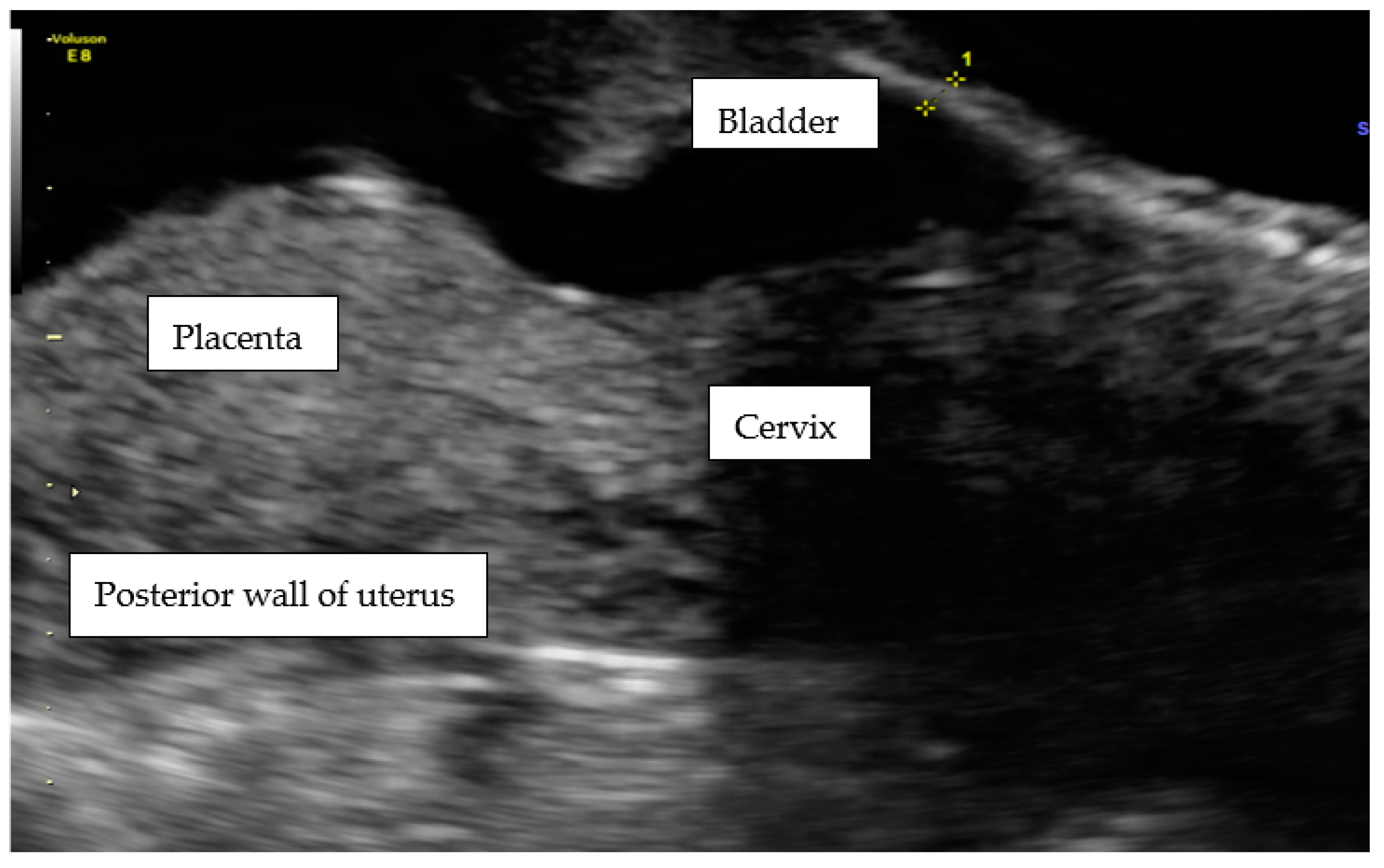 Ijerph 18 11998 g009