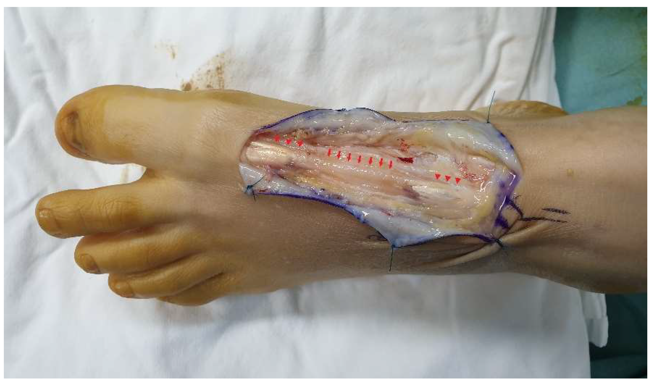 Ijerph 18 12157 g003 550