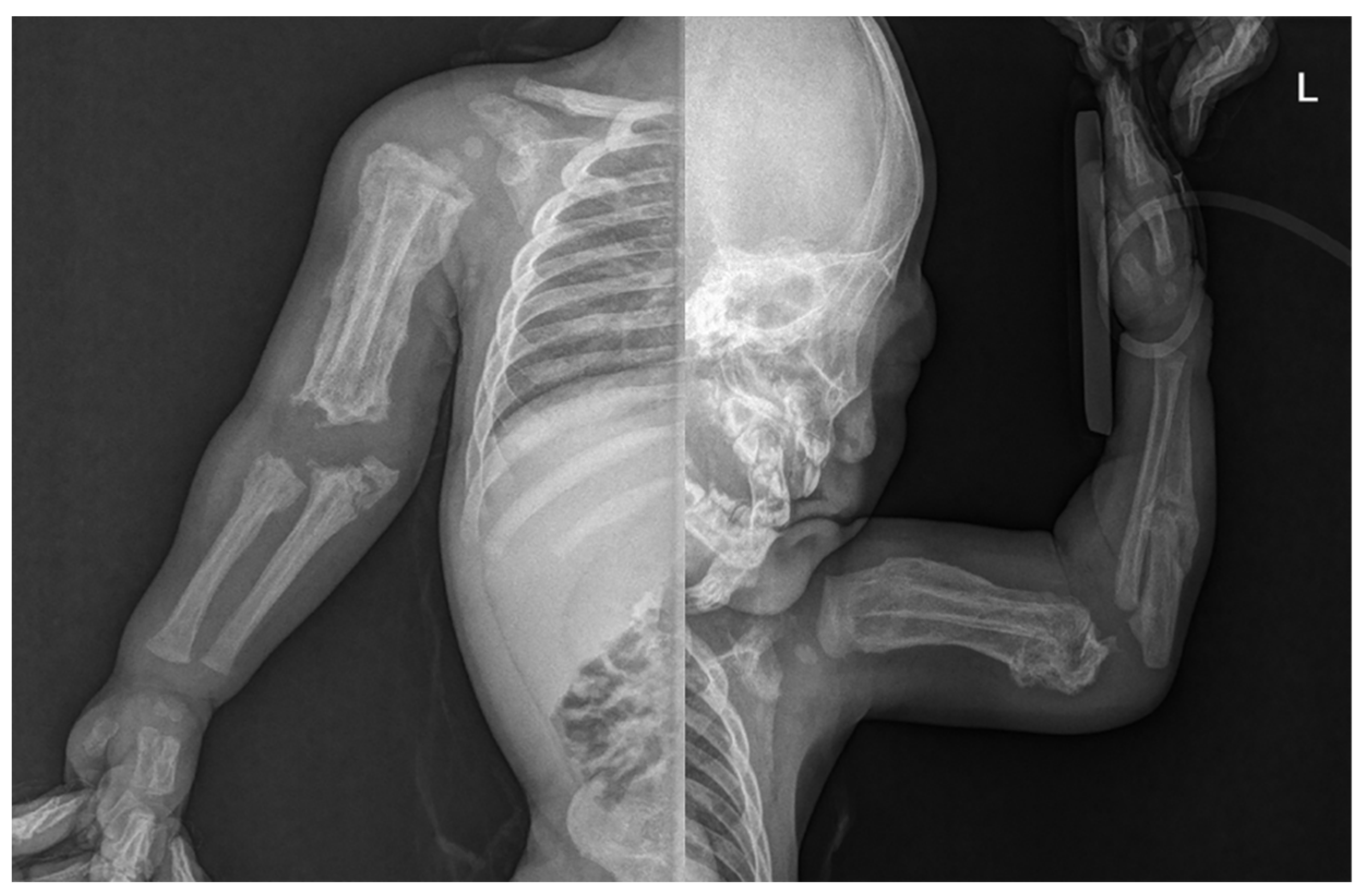 Ijerph 18 12269 g003