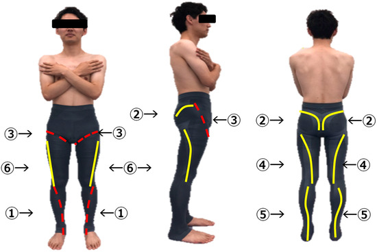 IJERPH Free Full-Text The Effect of Functional Biomechanics Garment for Walking