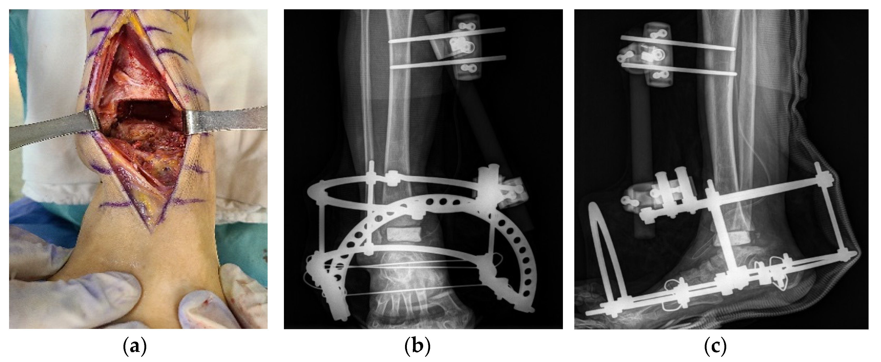 Ijerph 18 12473 g006