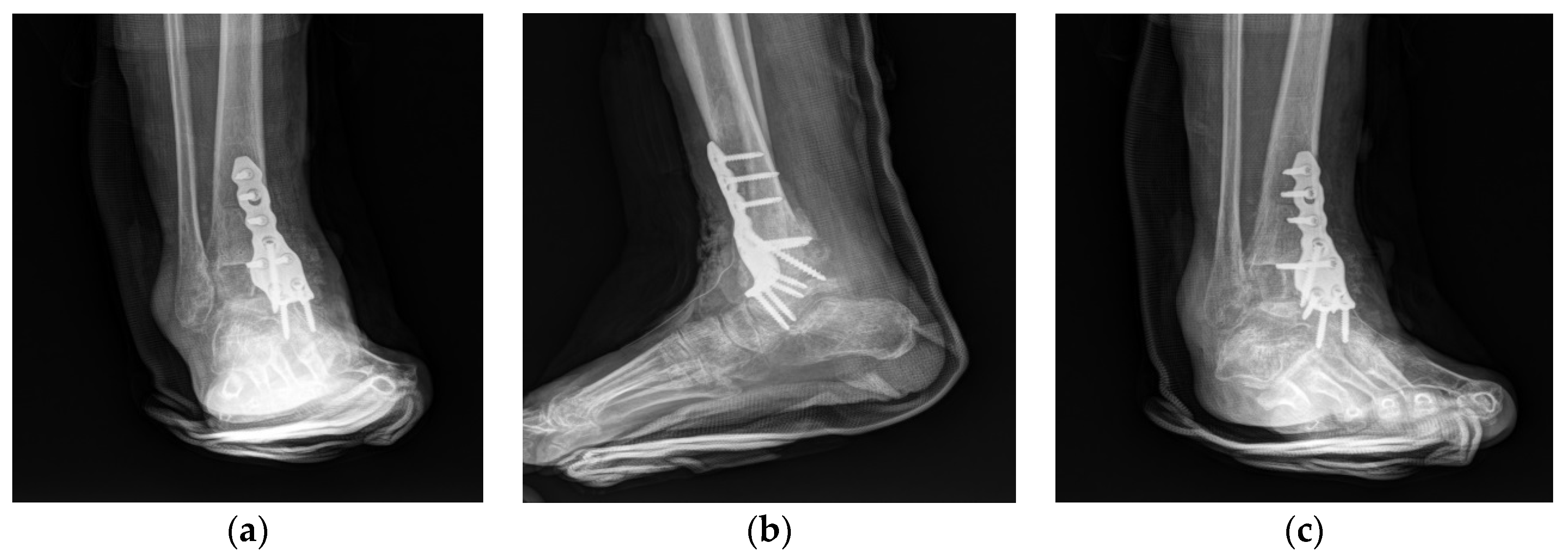 Ijerph 18 12473 g007