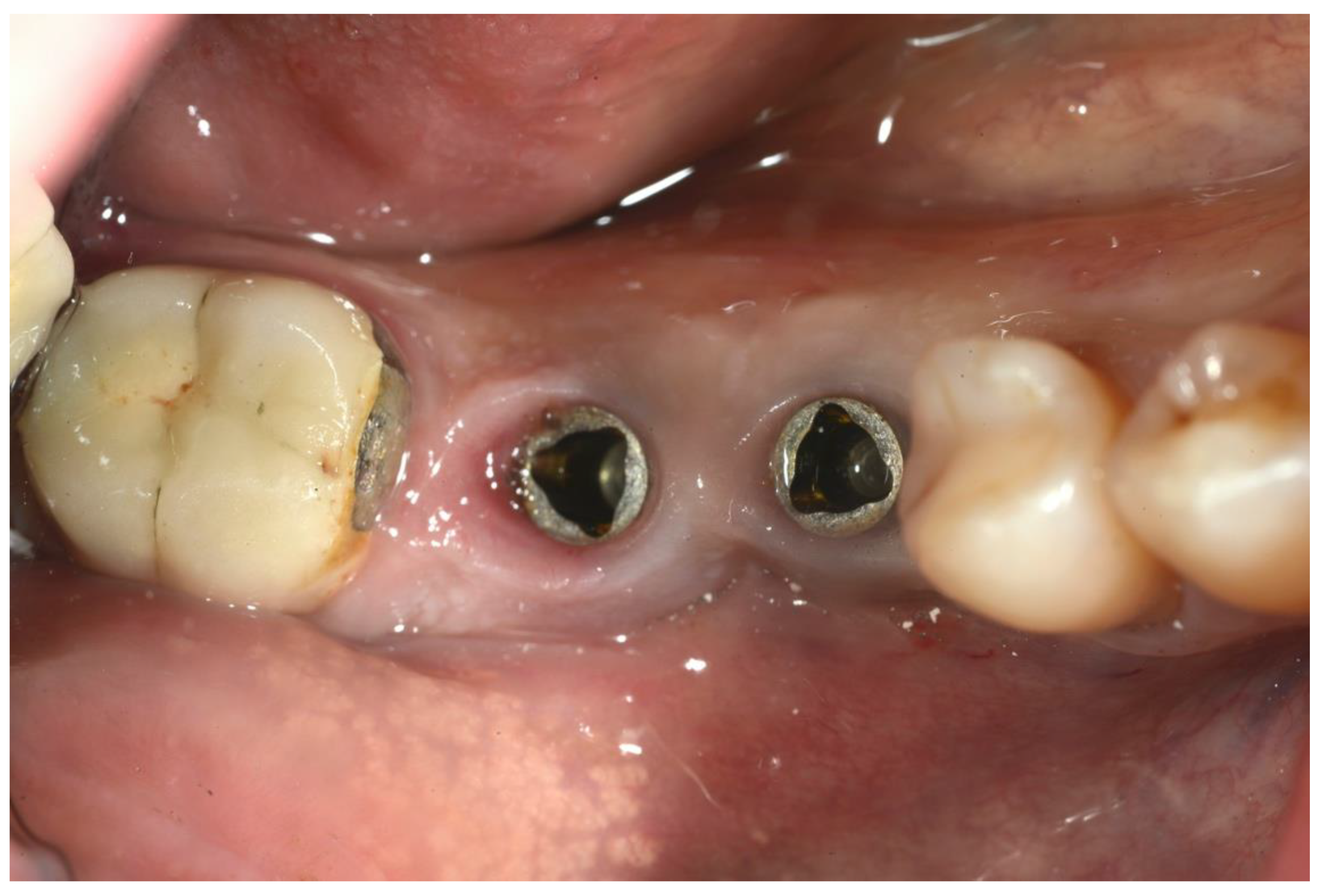 Ijerph 18 12658 g002 550