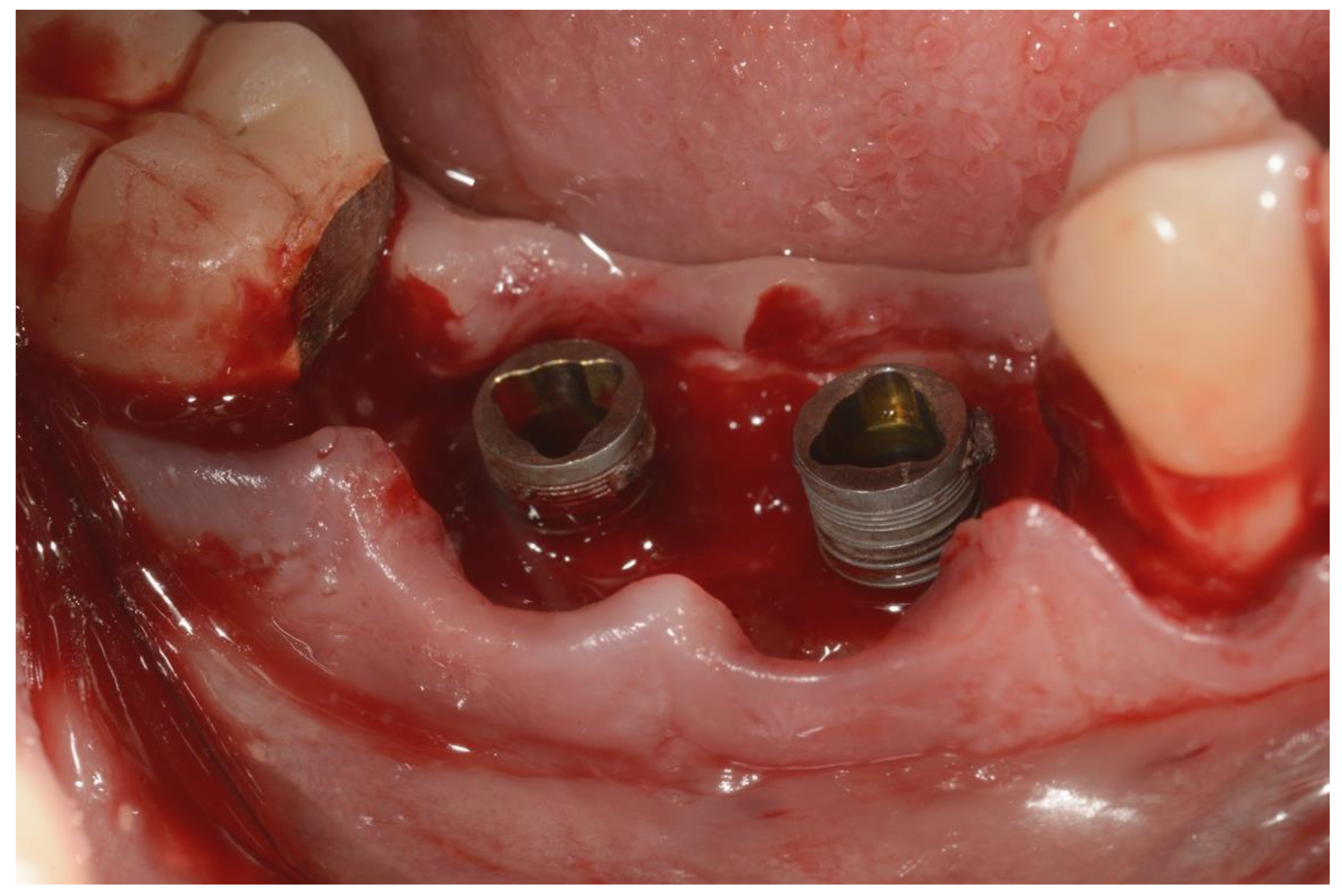 Ijerph 18 12658 g003 550