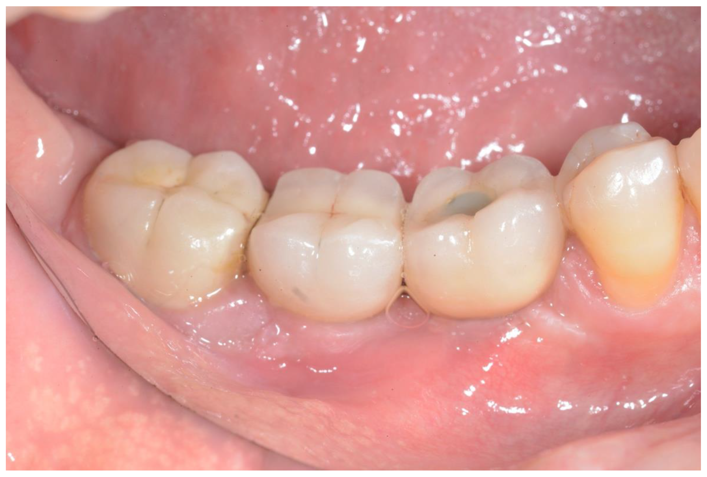 Ijerph 18 12658 g005 550