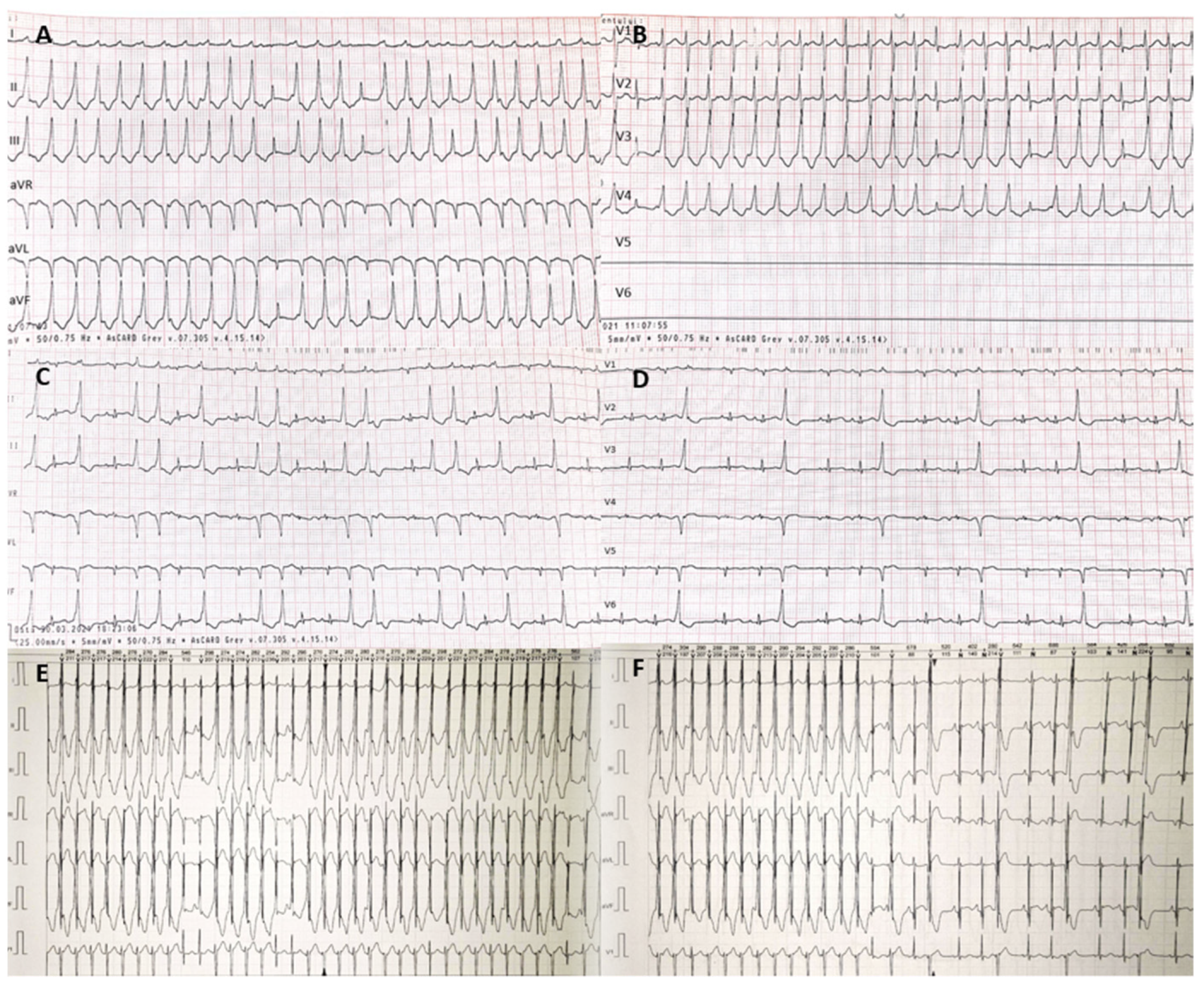 Ijerph 18 12796 g003 550