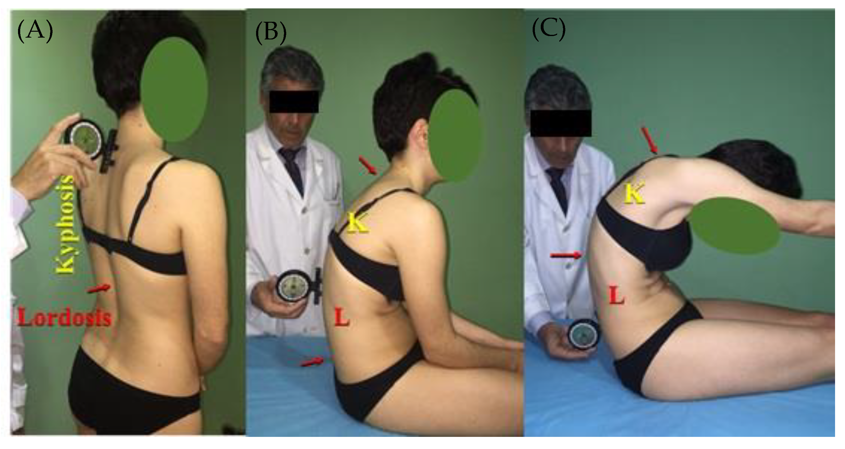 IJERPH Free Full-Text The Sagittal Integral Morphotype in Male and Female Rowers pic billede