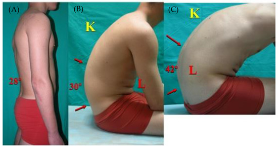 IJERPH Free Full-Text The Sagittal Integral Morphotype in Male and Female Rowers