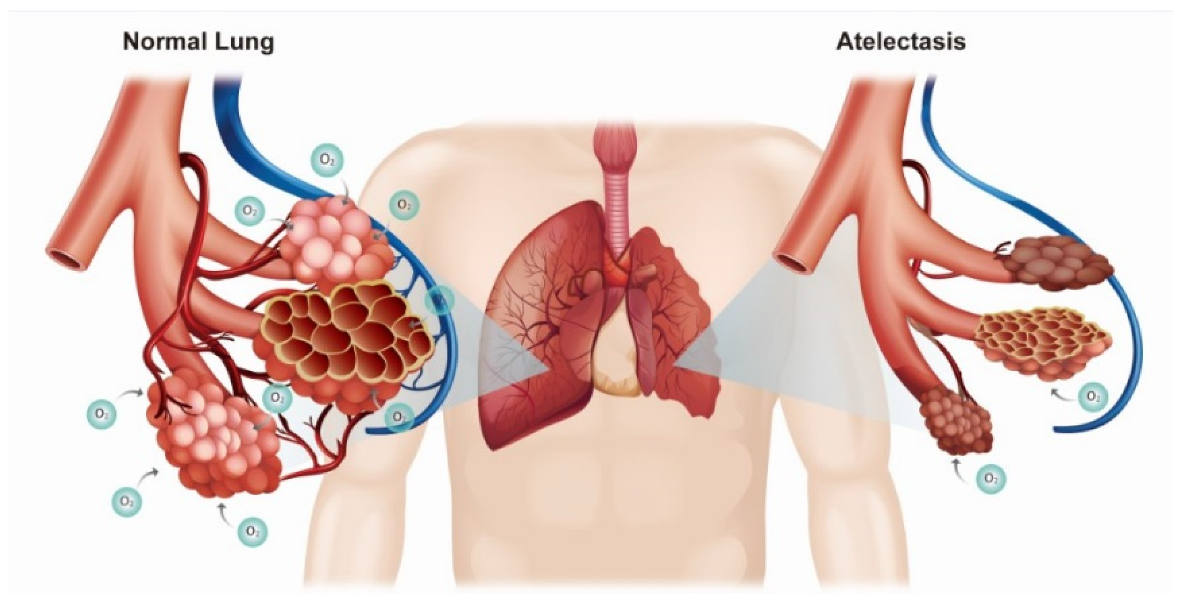 Ijerph 18 12931 g003 Ijerph 18 12931 g003