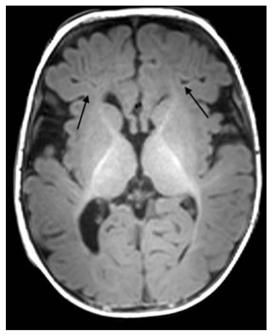 Ijerph 18 13201 g004