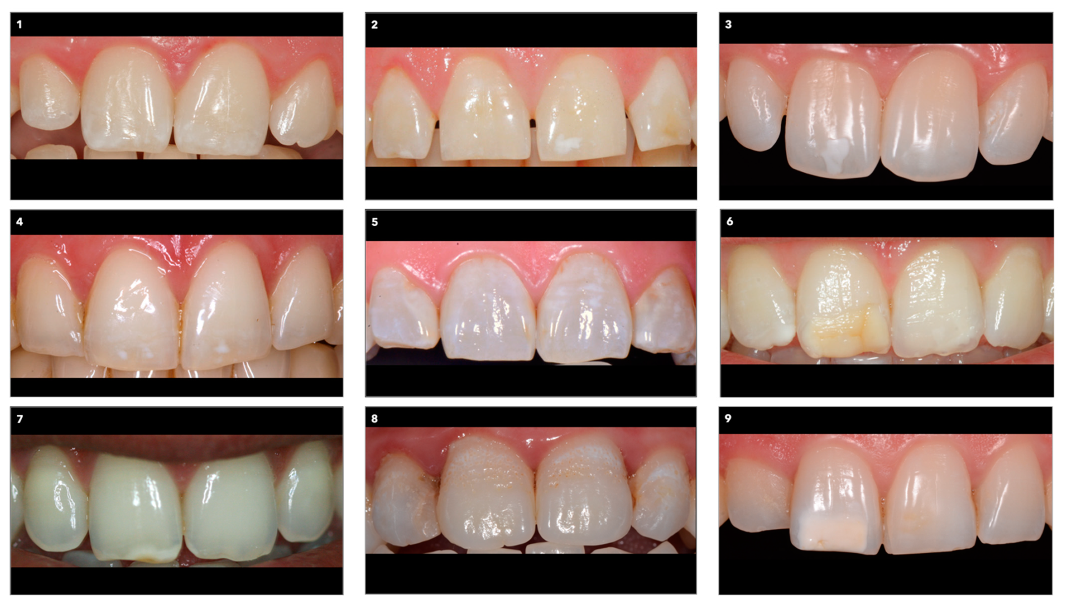 Ijerph 19 00900 g001